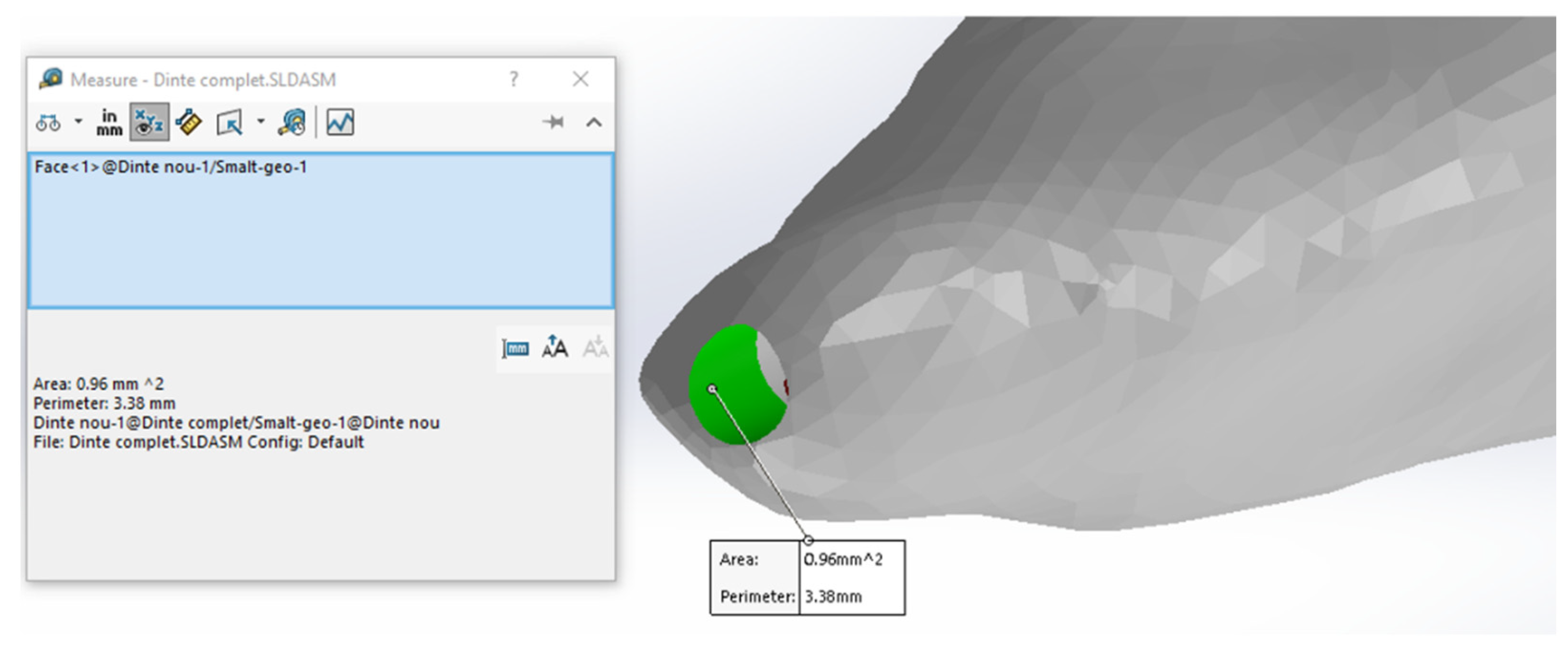 Diagnostics 13 01757 g014 Diagnostics 13 01757 g014