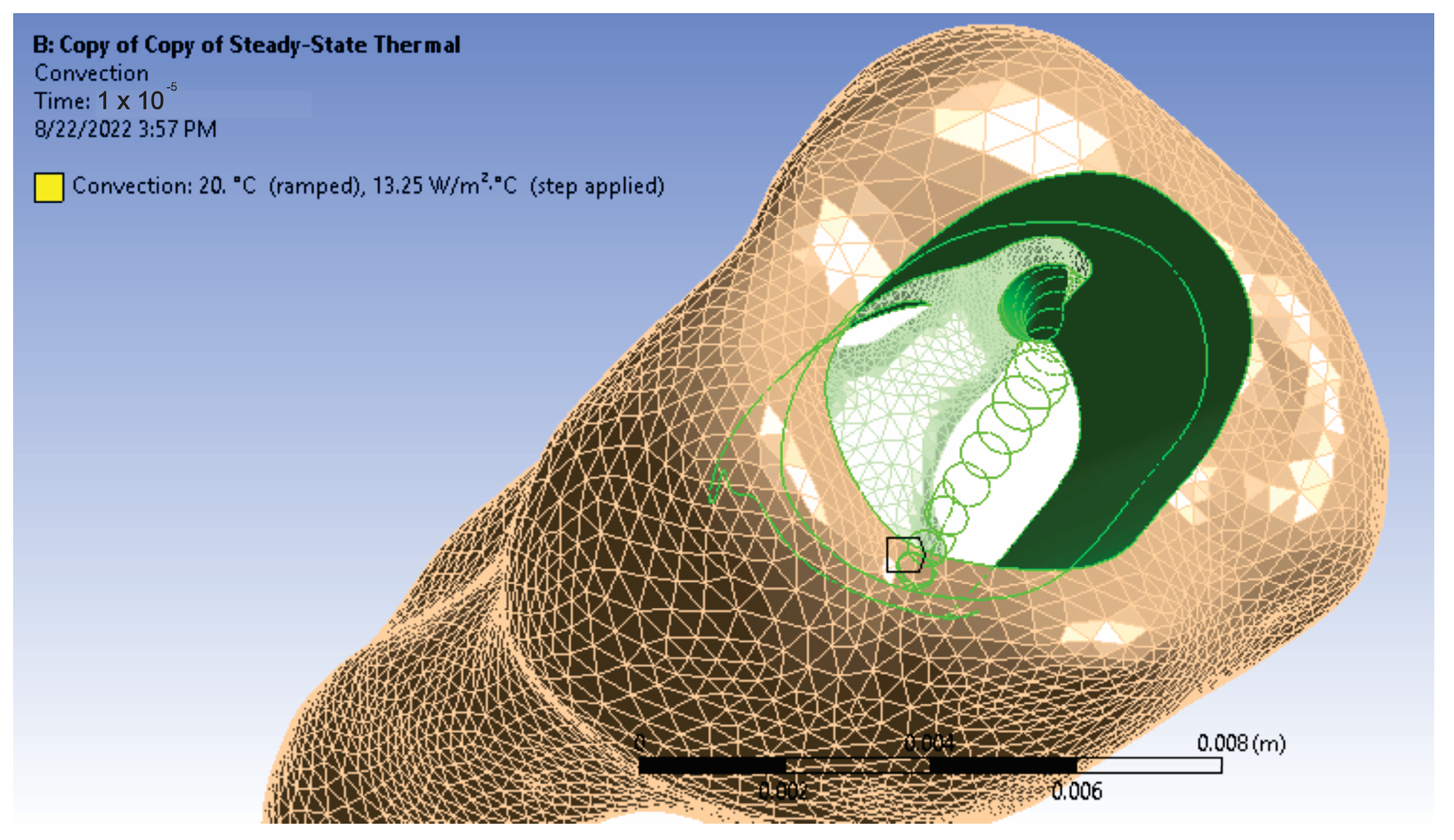 Diagnostics 13 01757 g016 Diagnostics 13 01757 g016