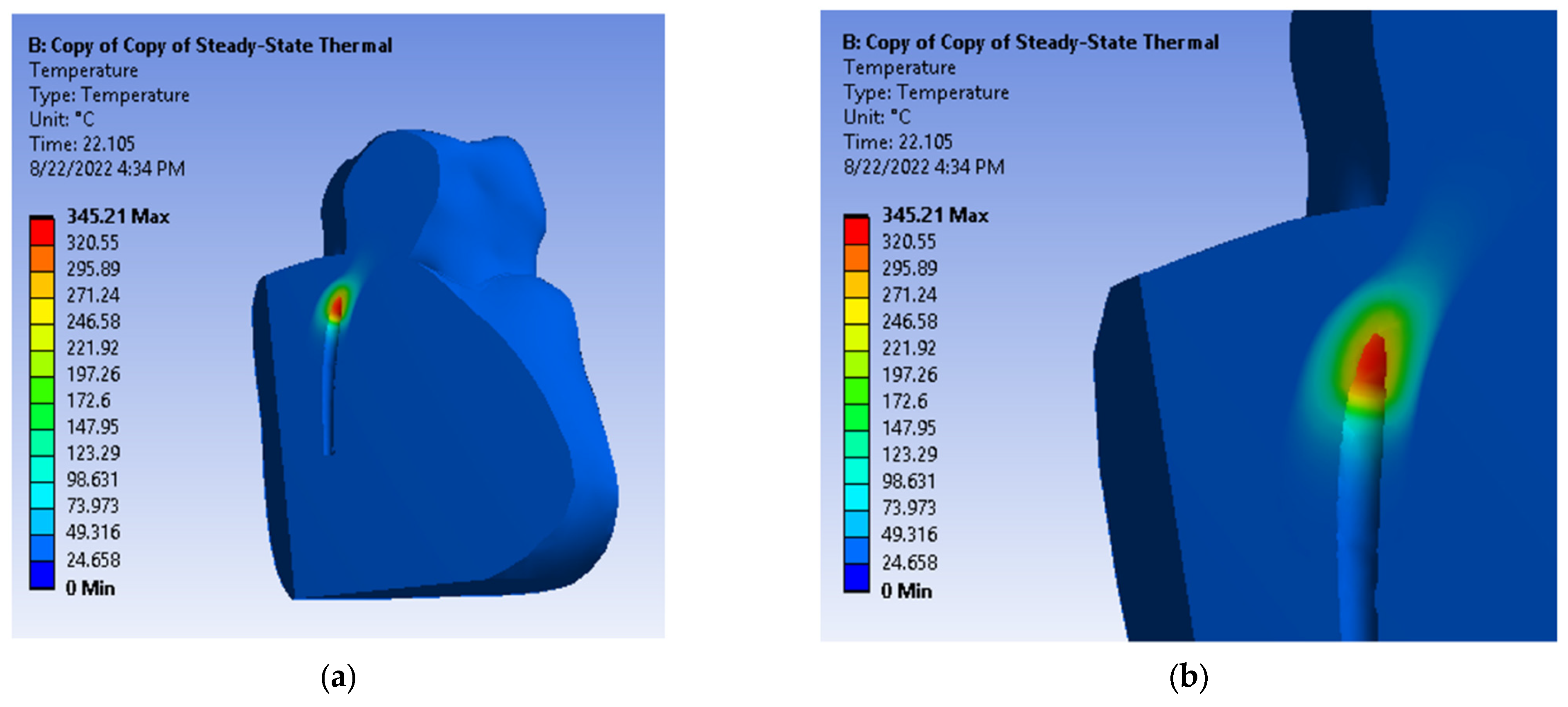 Diagnostics 13 01757 g018 Diagnostics 13 01757 g018