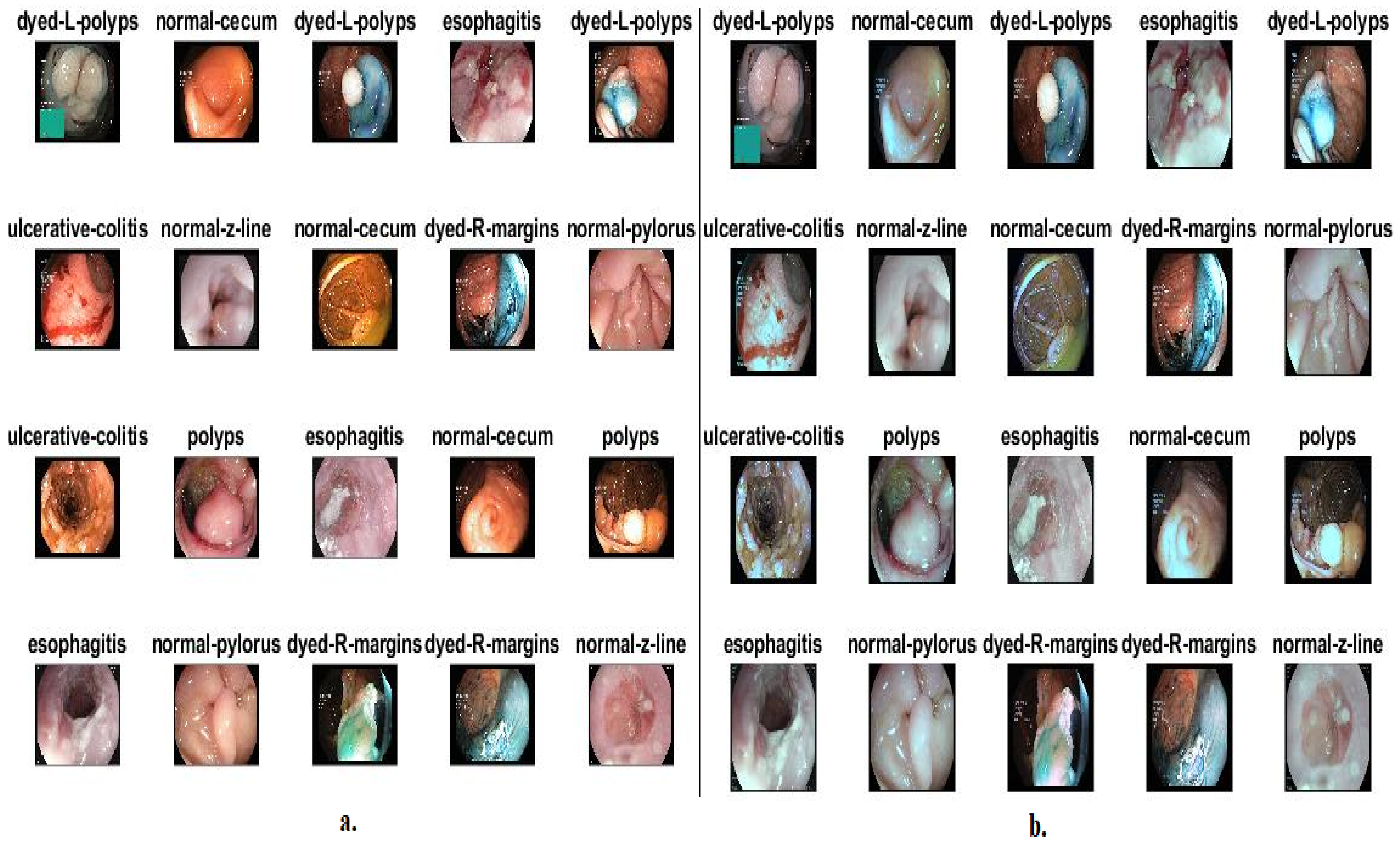 Diagnostics 13 01758 g001