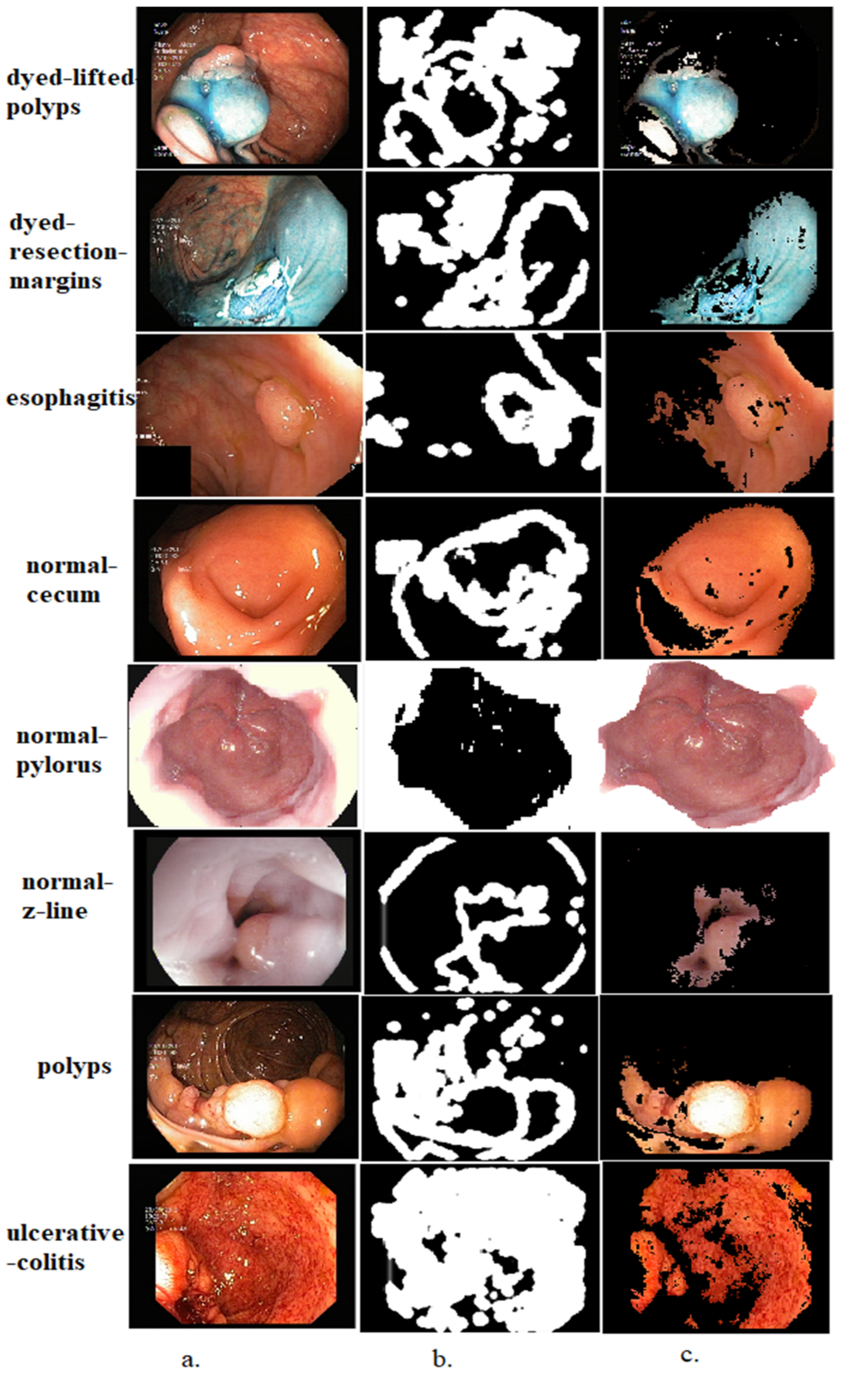 Diagnostics 13 01758 g002