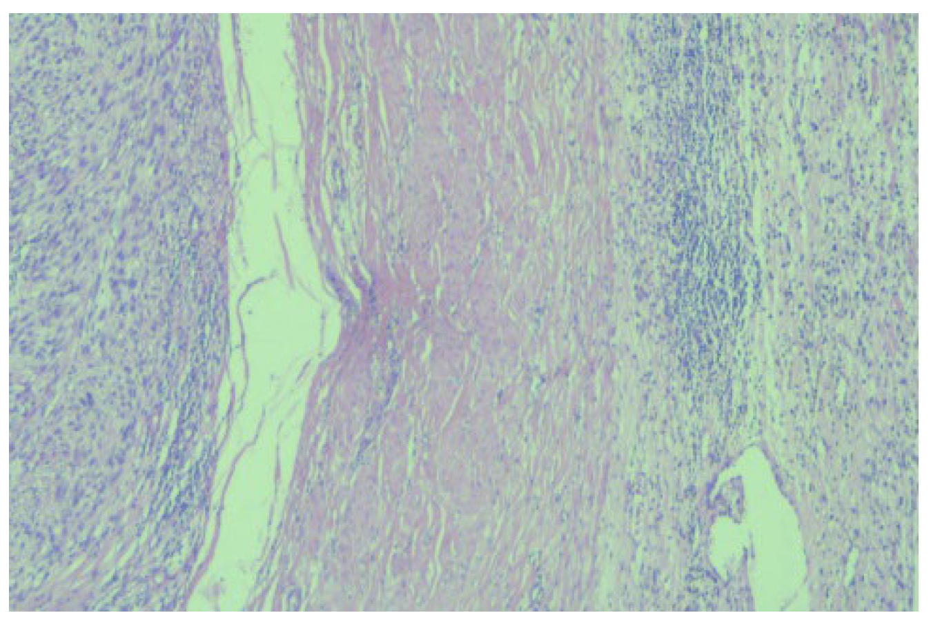 Diagnostics 13 01759 g003 Diagnostics 13 01759 g003