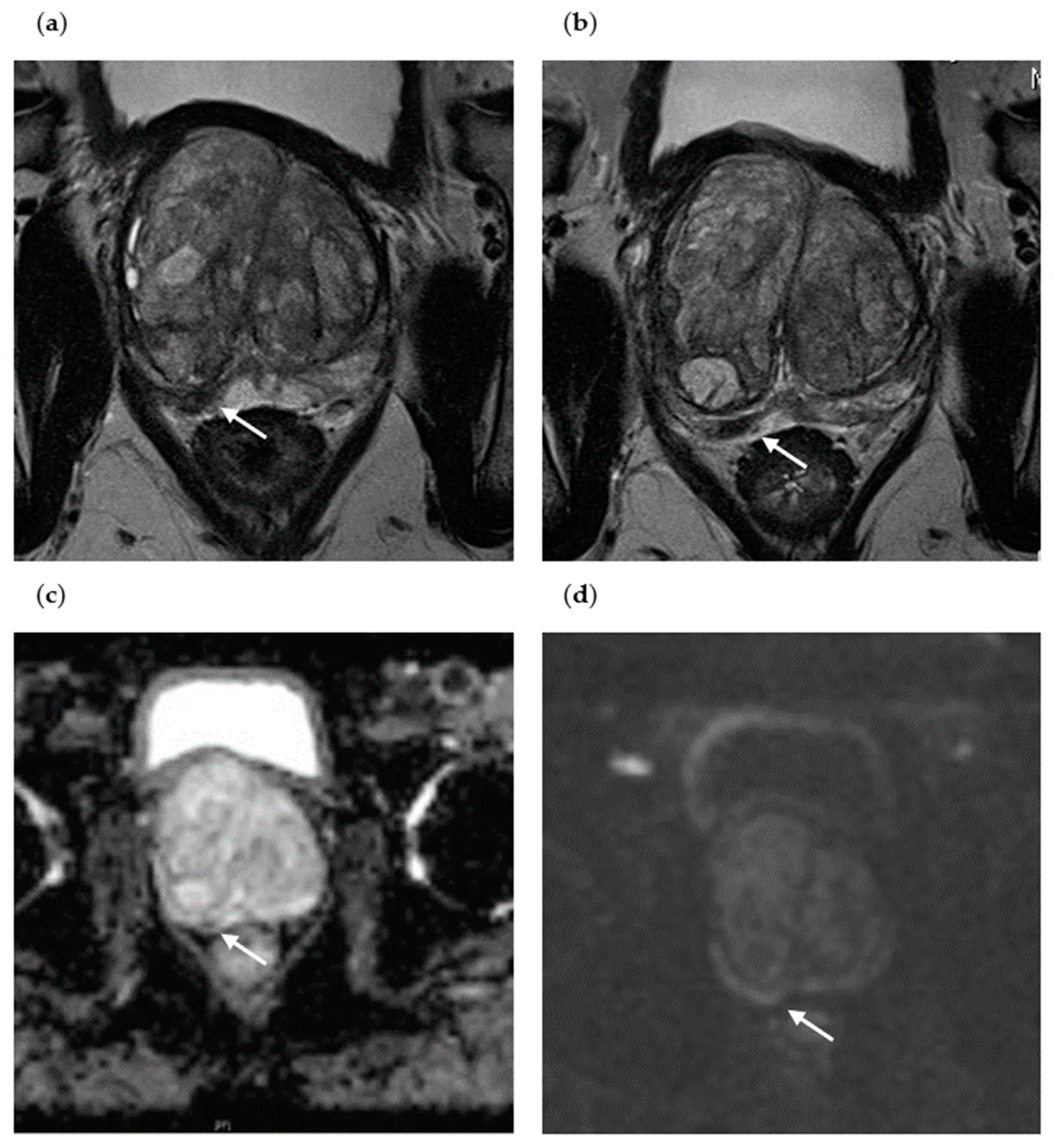 Diagnostics 13 01761 g003