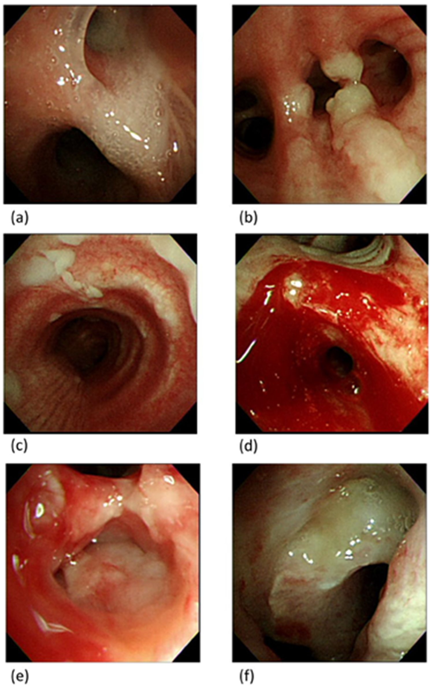 Diagnostics 13 01764 g002 Diagnostics 13 01764 g002