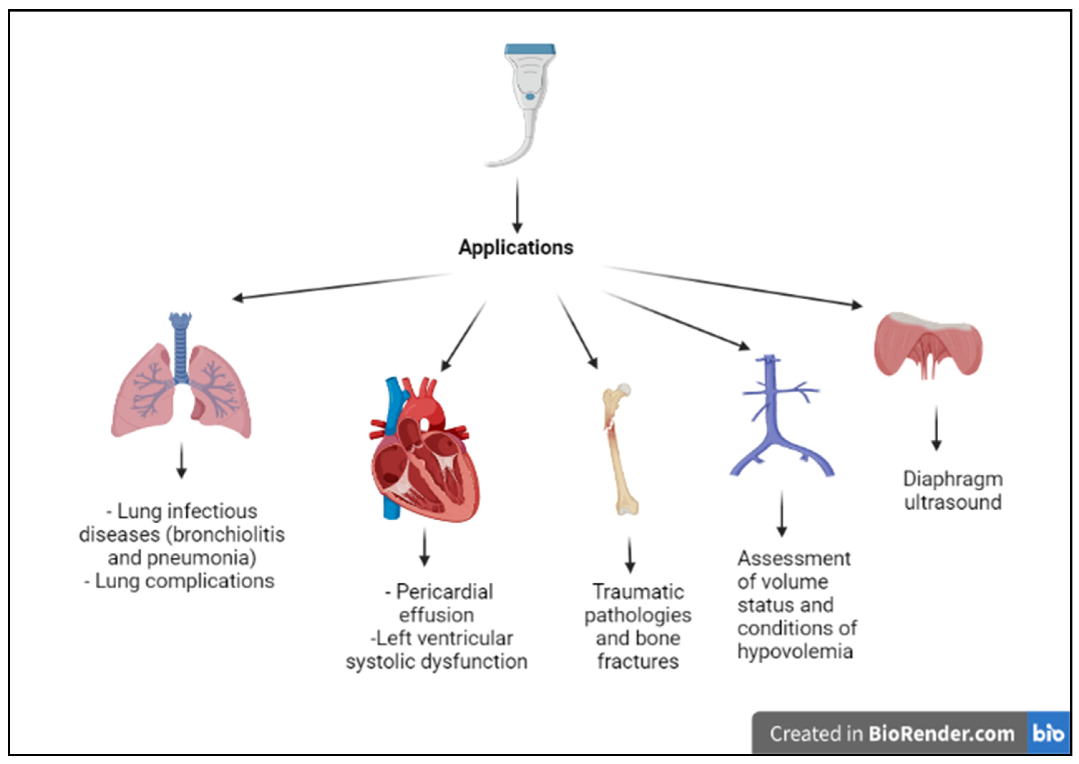 Diagnostics | Free Full-Text | Point-of-Care Thoracic Ultrasound in