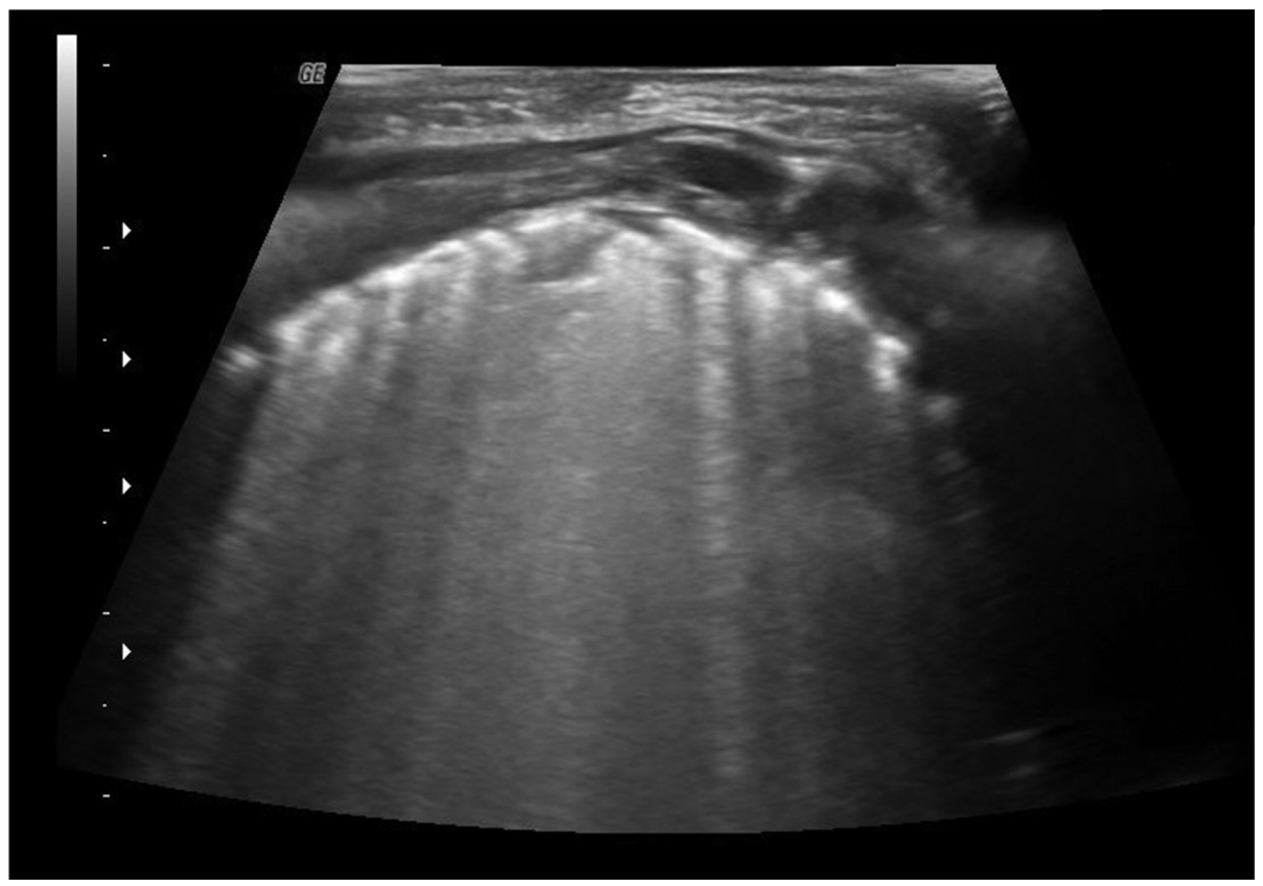 Diagnostics 13 01765 g002 Diagnostics 13 01765 g002