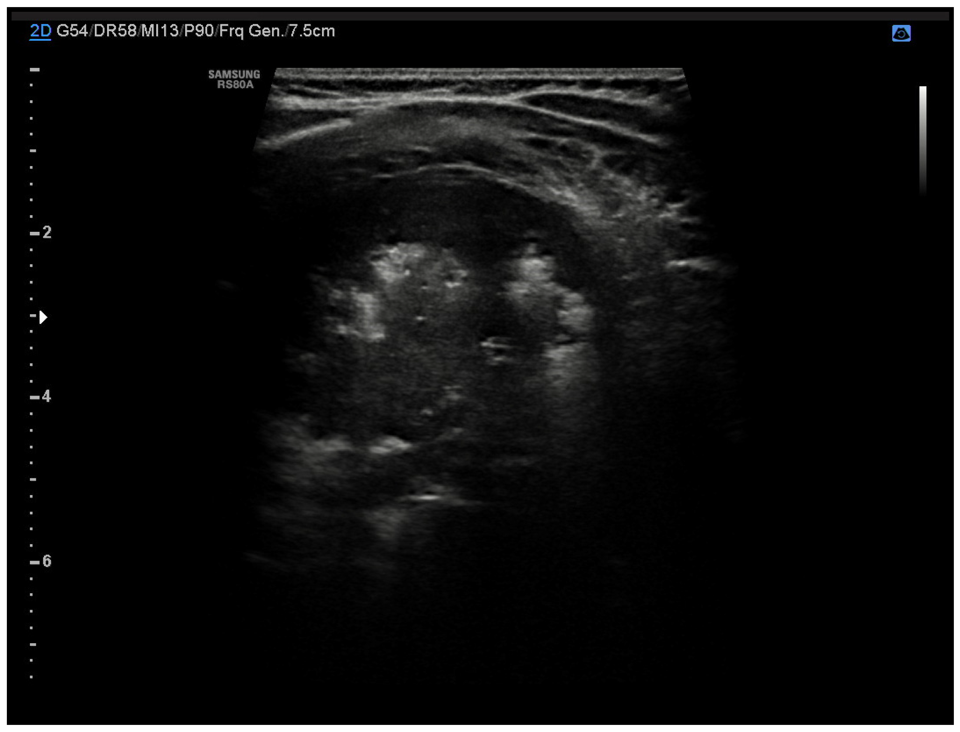 Diagnostics 13 01765 g003 Diagnostics 13 01765 g003