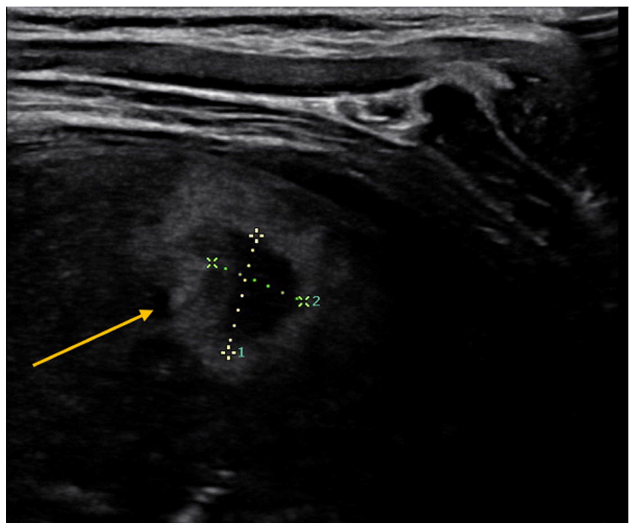 Diagnostics 13 01765 g004 Diagnostics 13 01765 g004