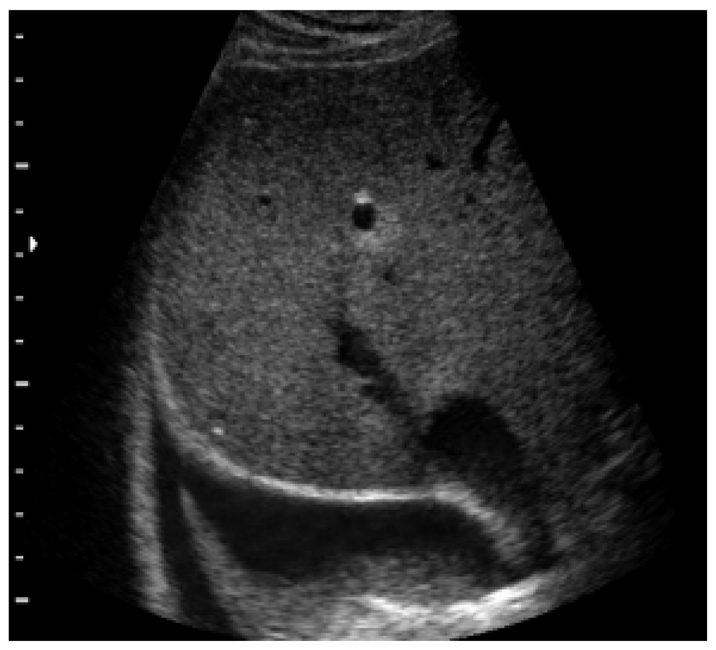 Diagnostics 13 01765 g005 Diagnostics 13 01765 g005