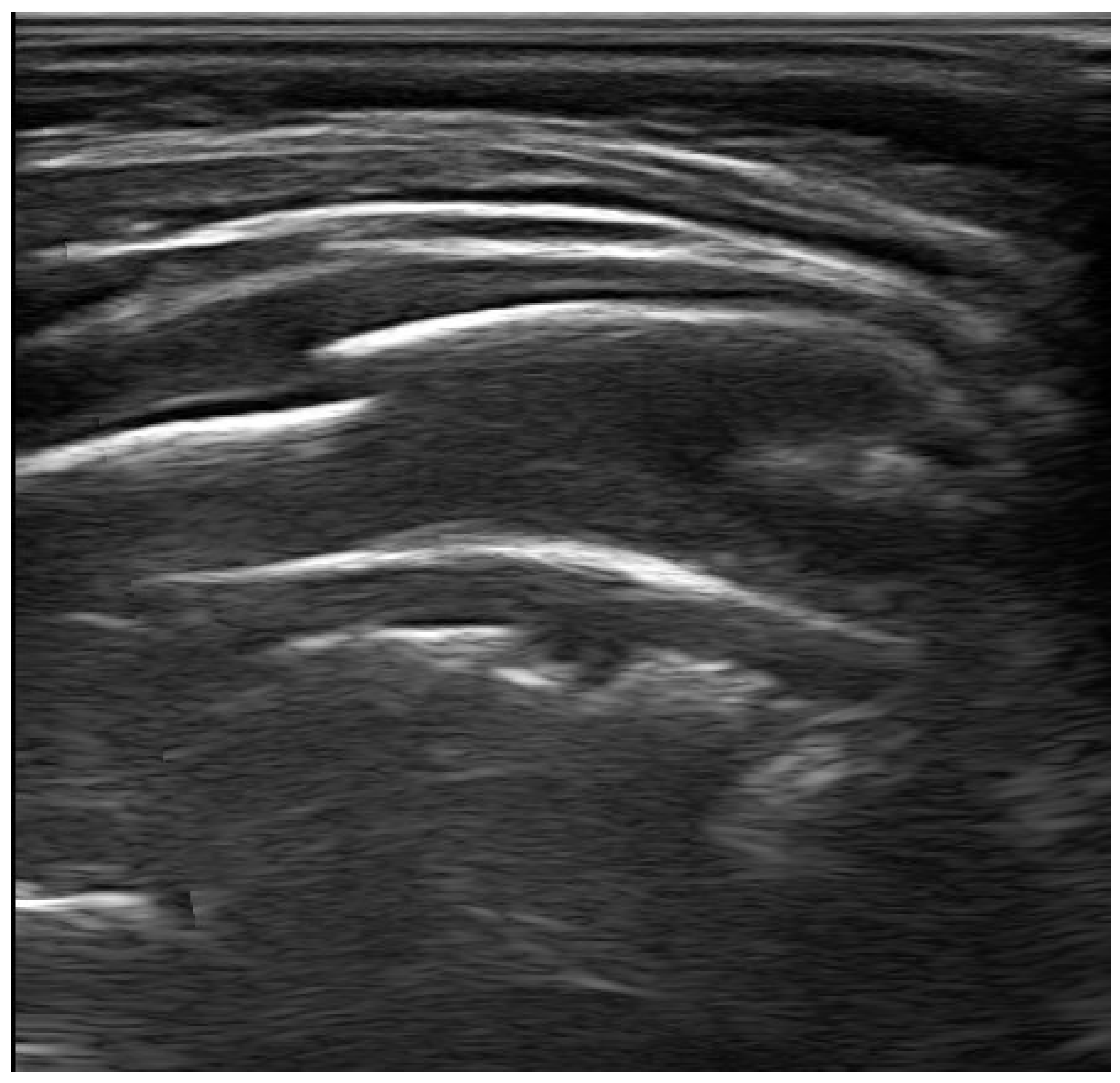 Diagnostics 13 01765 g006 Diagnostics 13 01765 g006