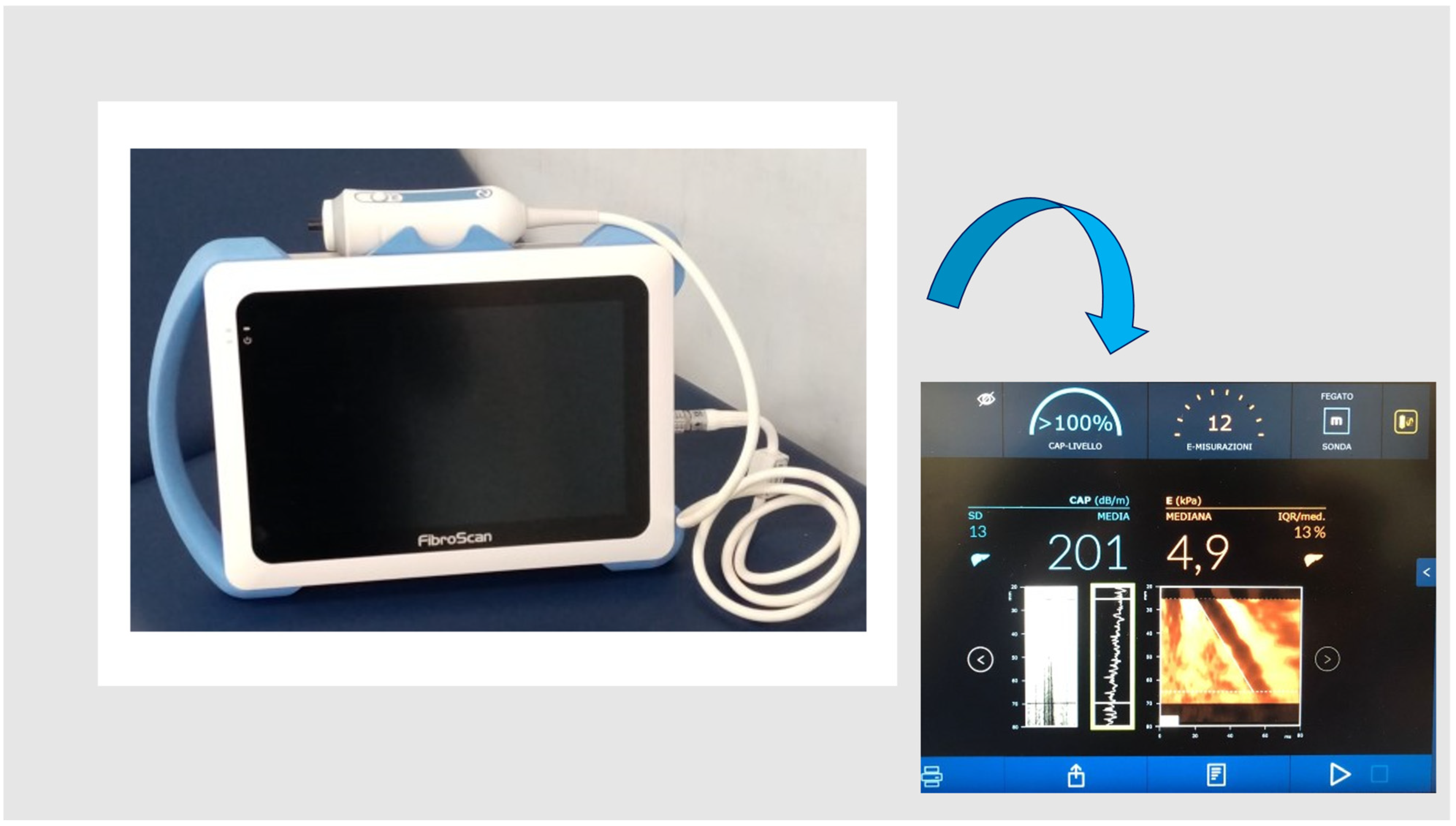 Diagnostics 13 01766 g001