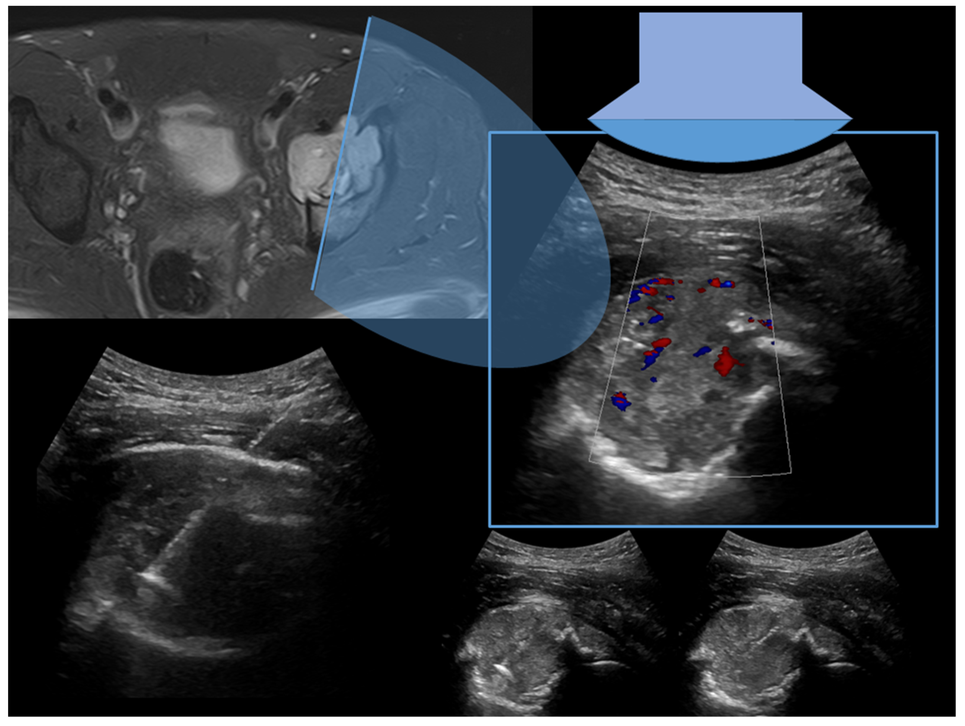 Diagnostics 13 01773 g003 Diagnostics 13 01773 g003