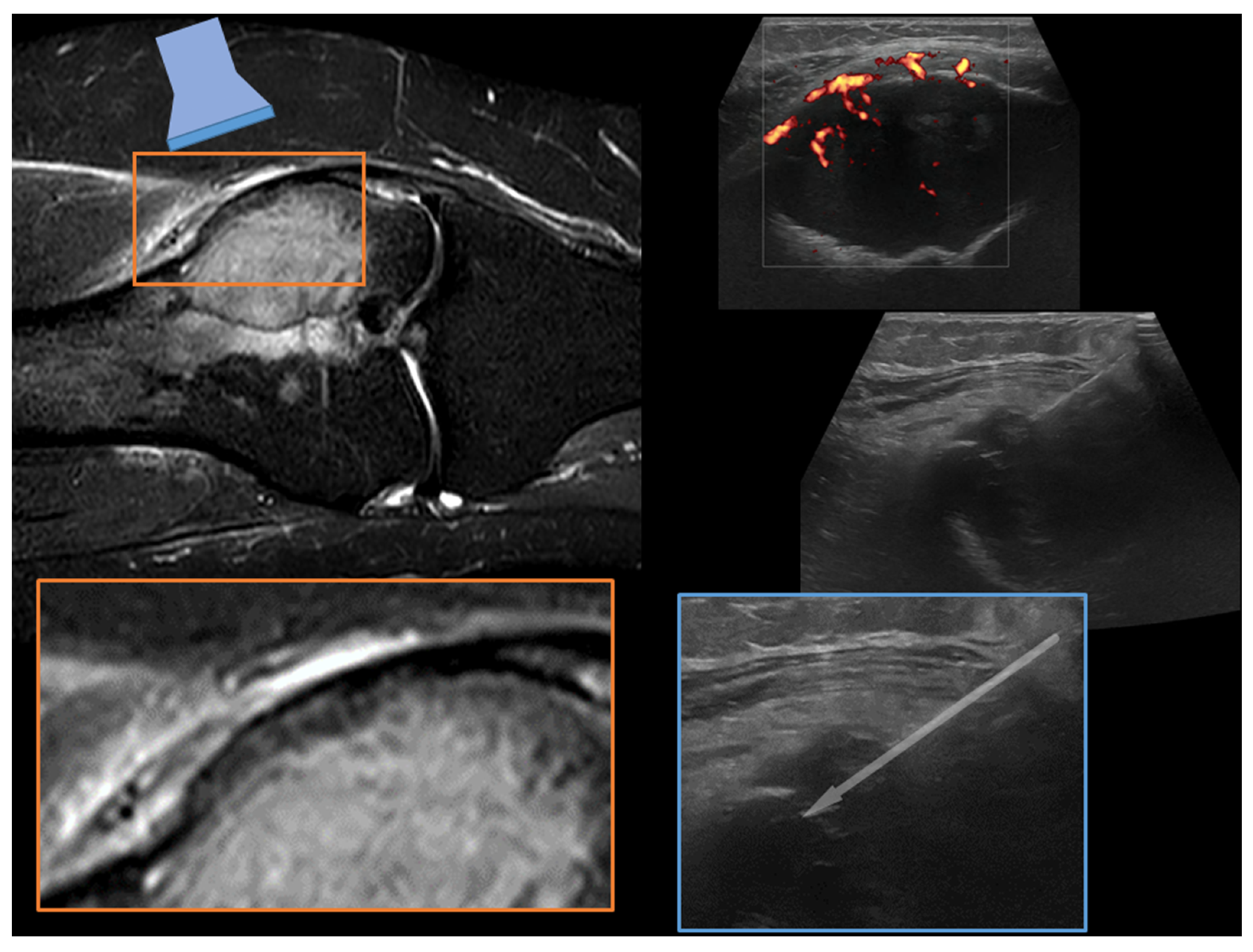 Diagnostics 13 01773 g004 Diagnostics 13 01773 g004