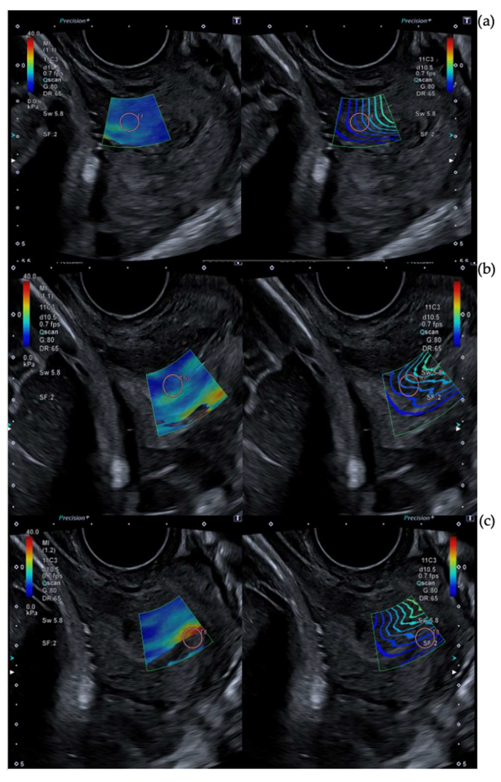 Diagnostics 13 01782 g001 Diagnostics 13 01782 g001