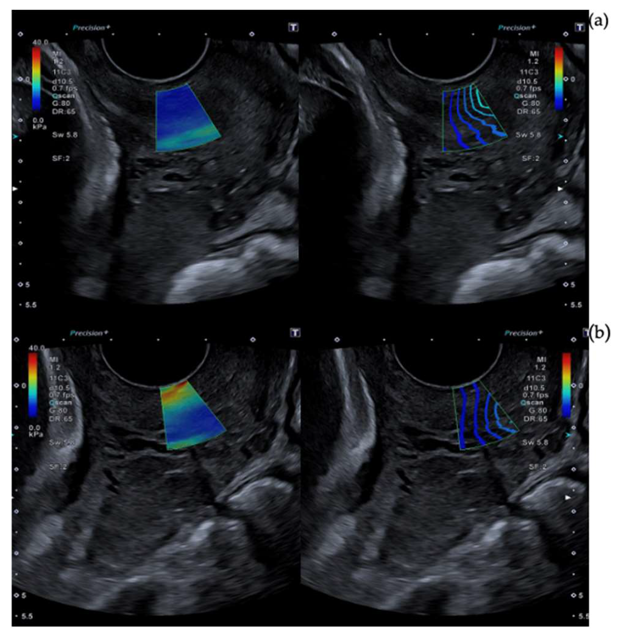 Diagnostics 13 01782 g003 Diagnostics 13 01782 g003