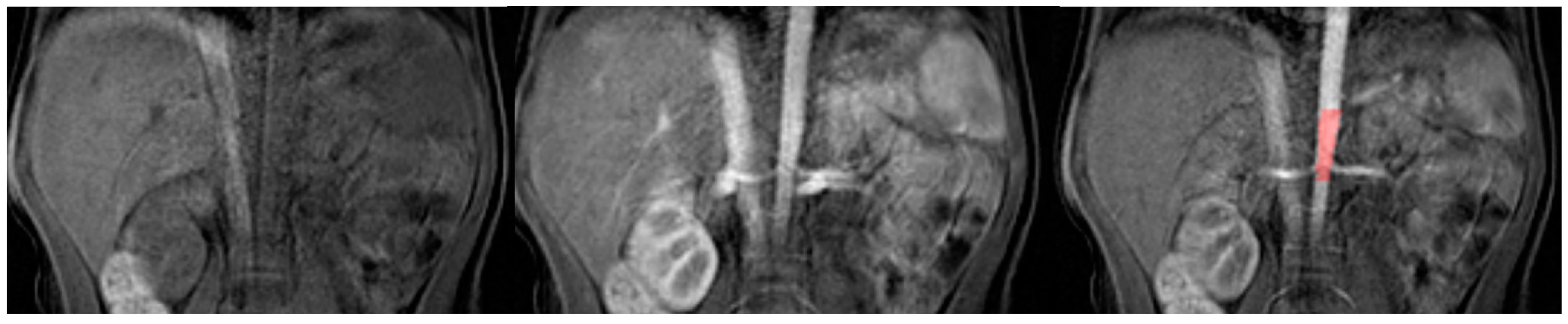 Diagnostics 13 01786 g003