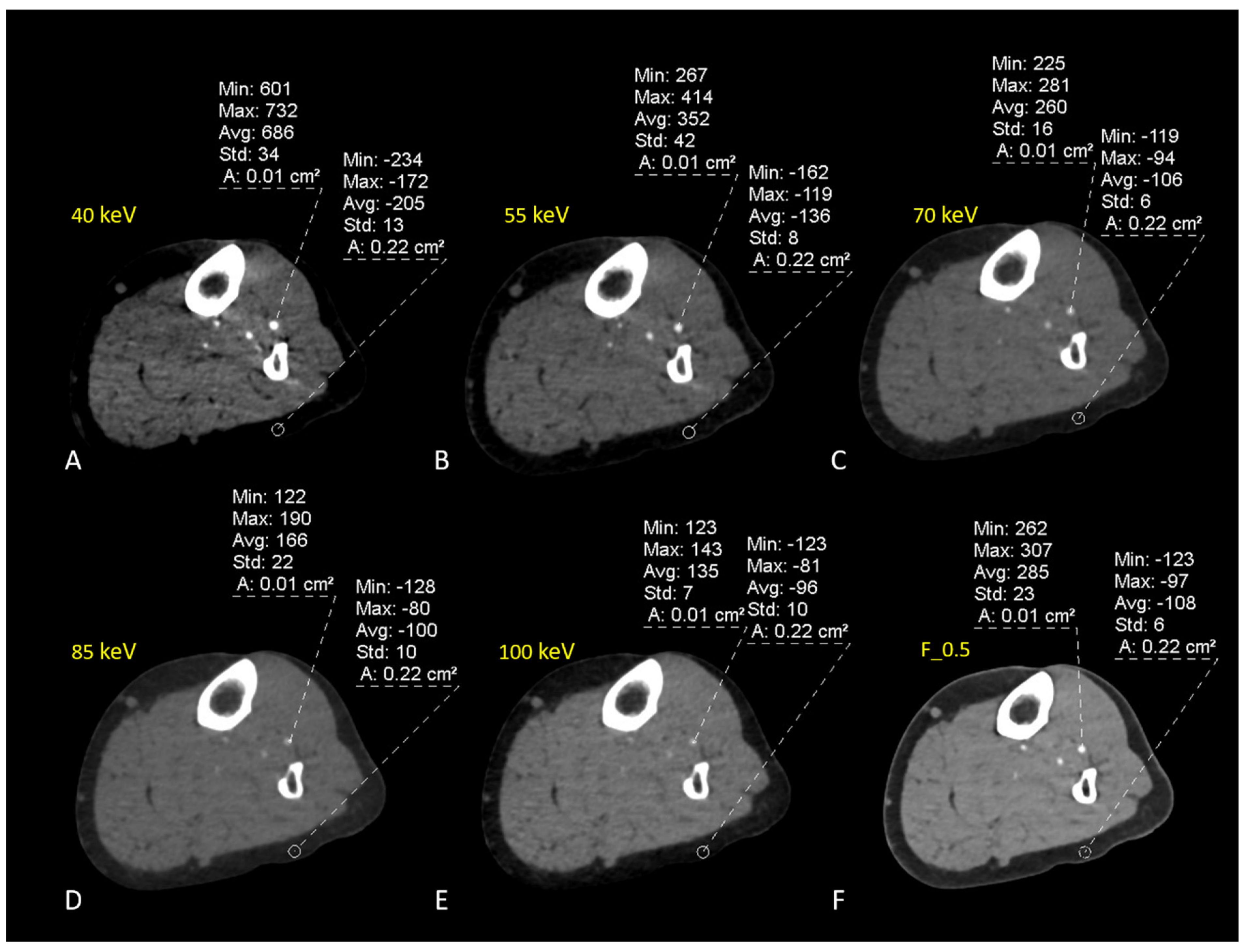 Diagnostics 13 01790 g005 Diagnostics 13 01790 g005