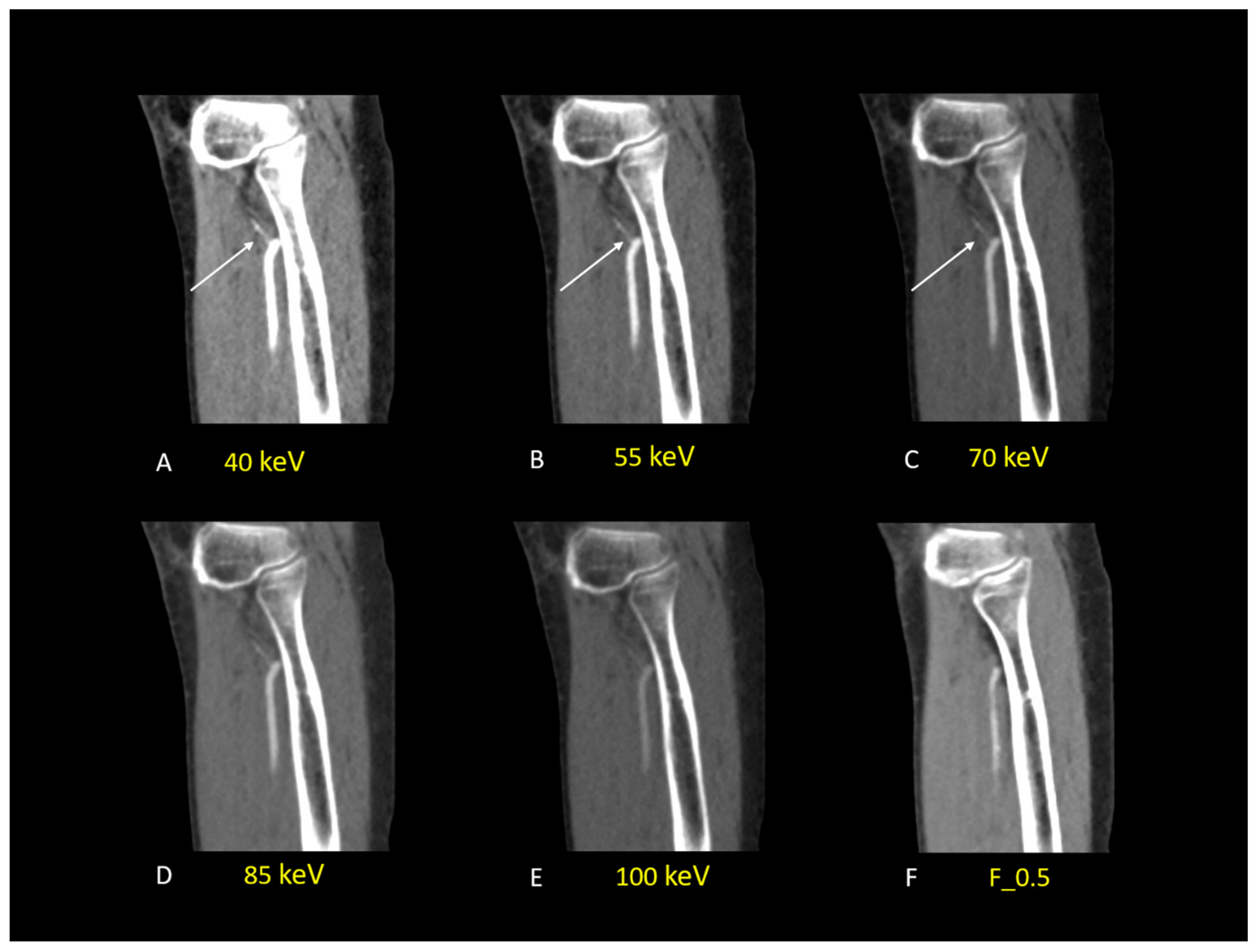 Diagnostics 13 01790 g006 Diagnostics 13 01790 g006