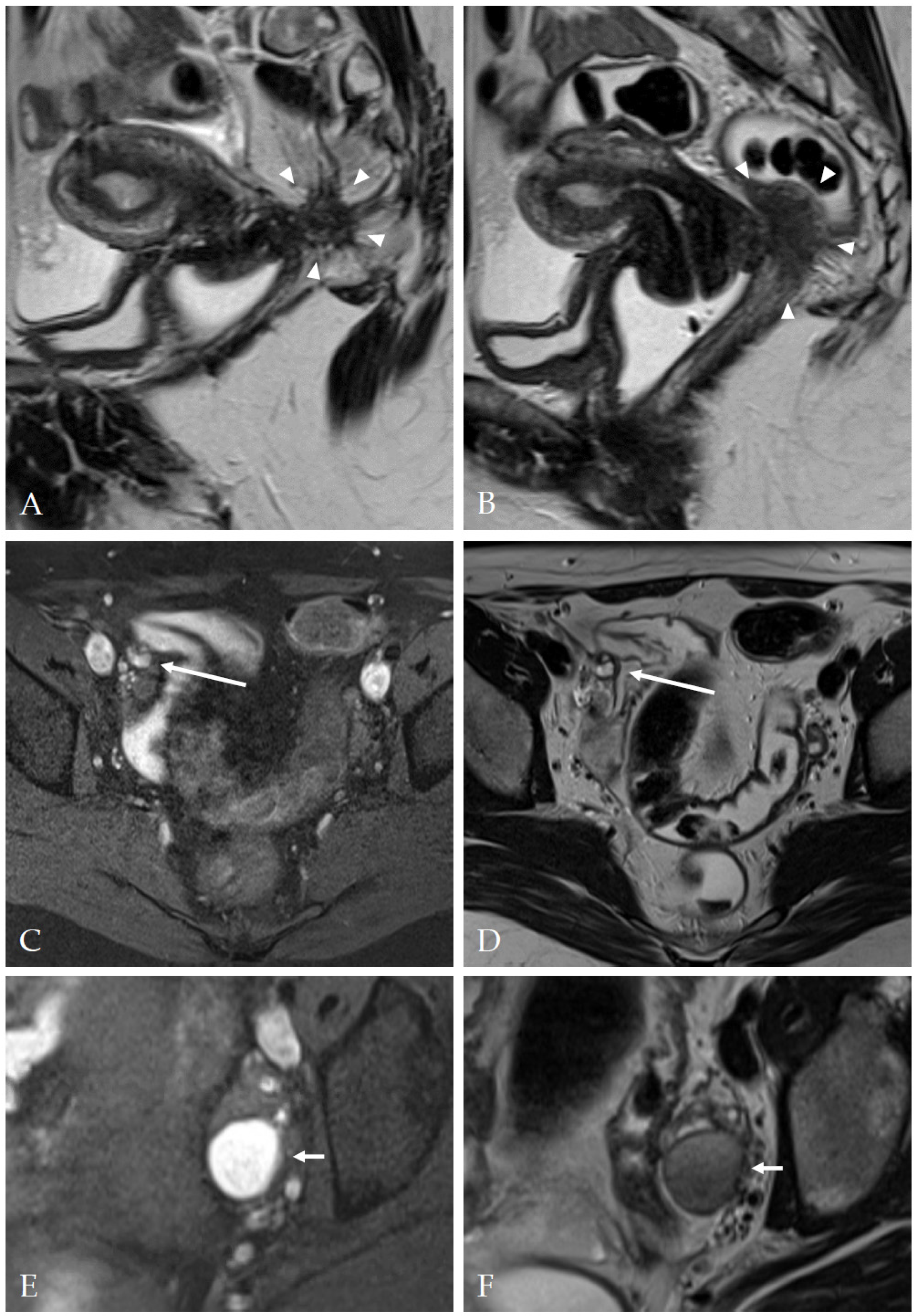 Diagnostics 13 01794 g004 Diagnostics 13 01794 g004