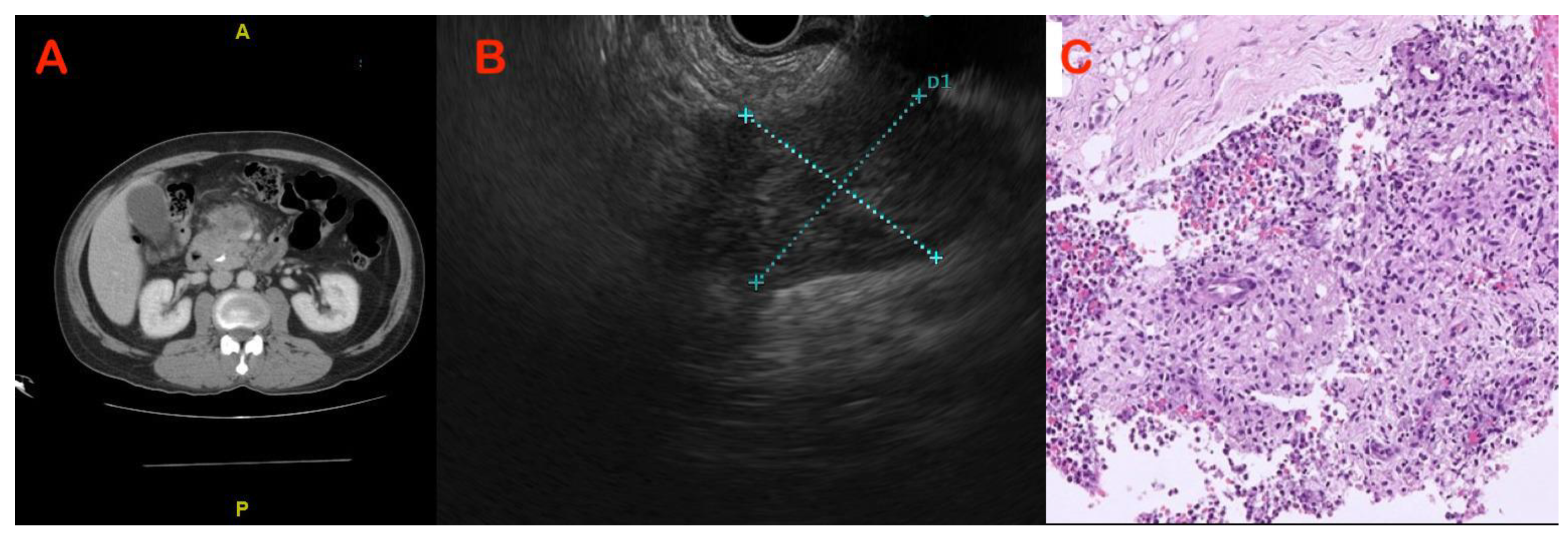 Diagnostics 13 01797 g002 Diagnostics 13 01797 g002