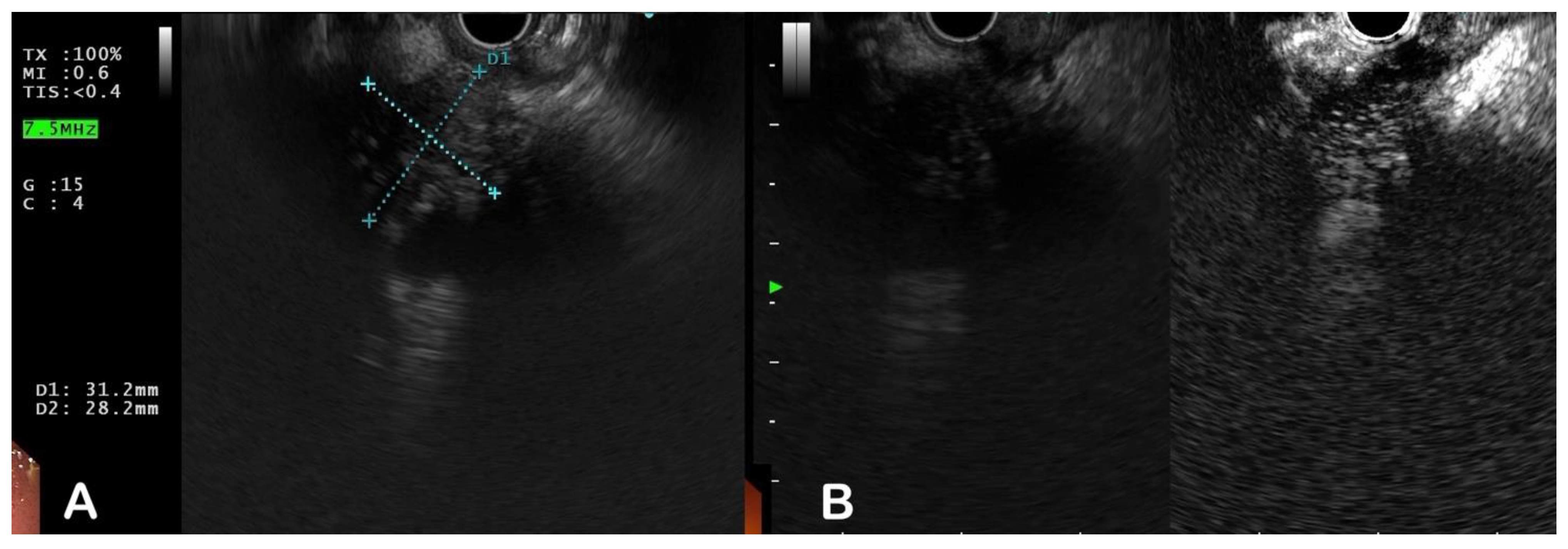 Diagnostics 13 01797 g003 Diagnostics 13 01797 g003