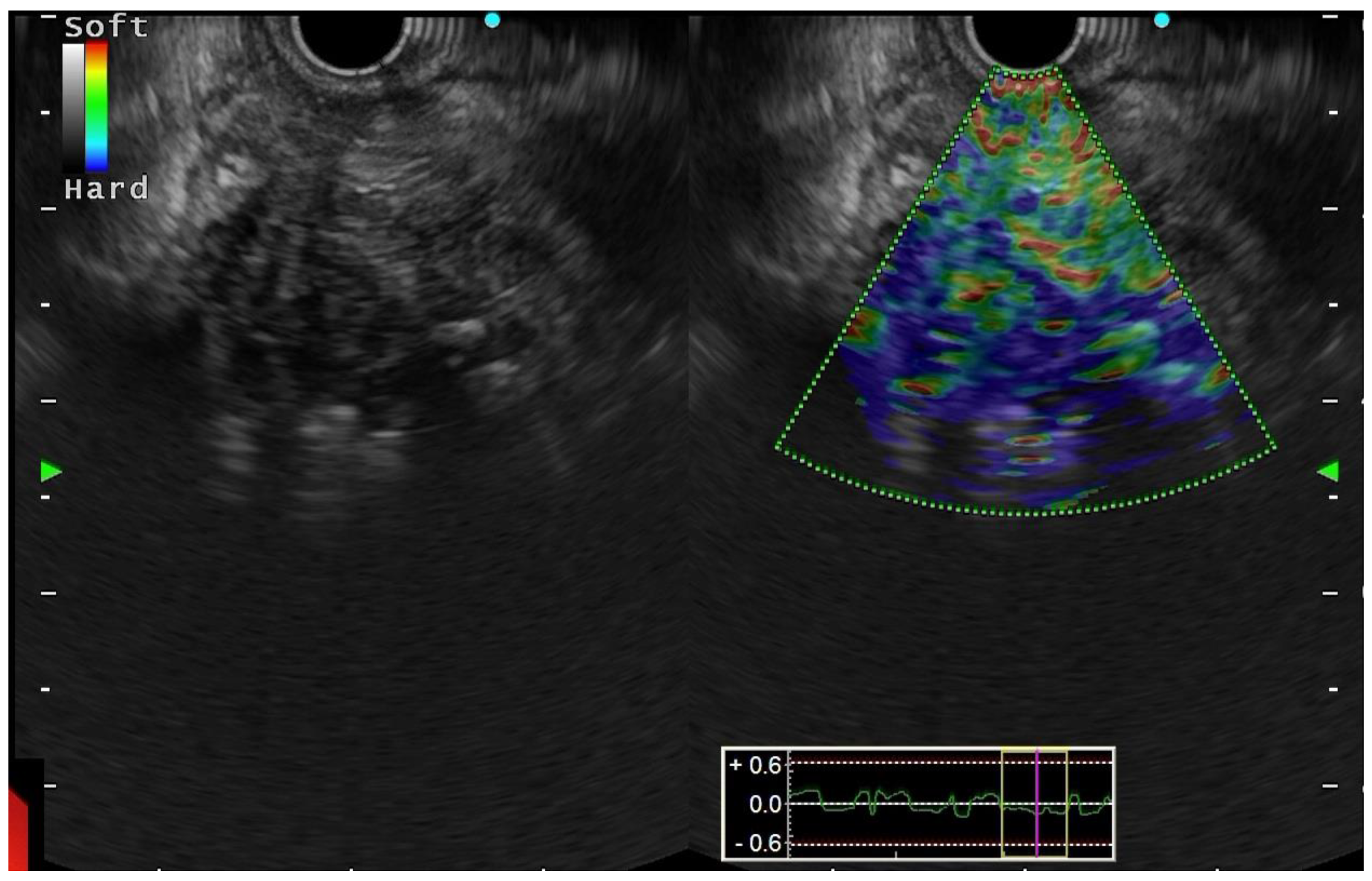 Diagnostics 13 01797 g004 Diagnostics 13 01797 g004