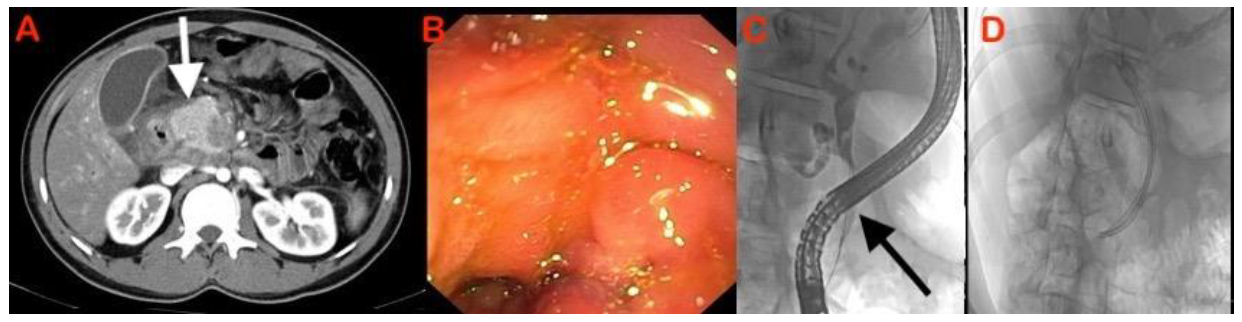 Diagnostics 13 01797 g005 Diagnostics 13 01797 g005