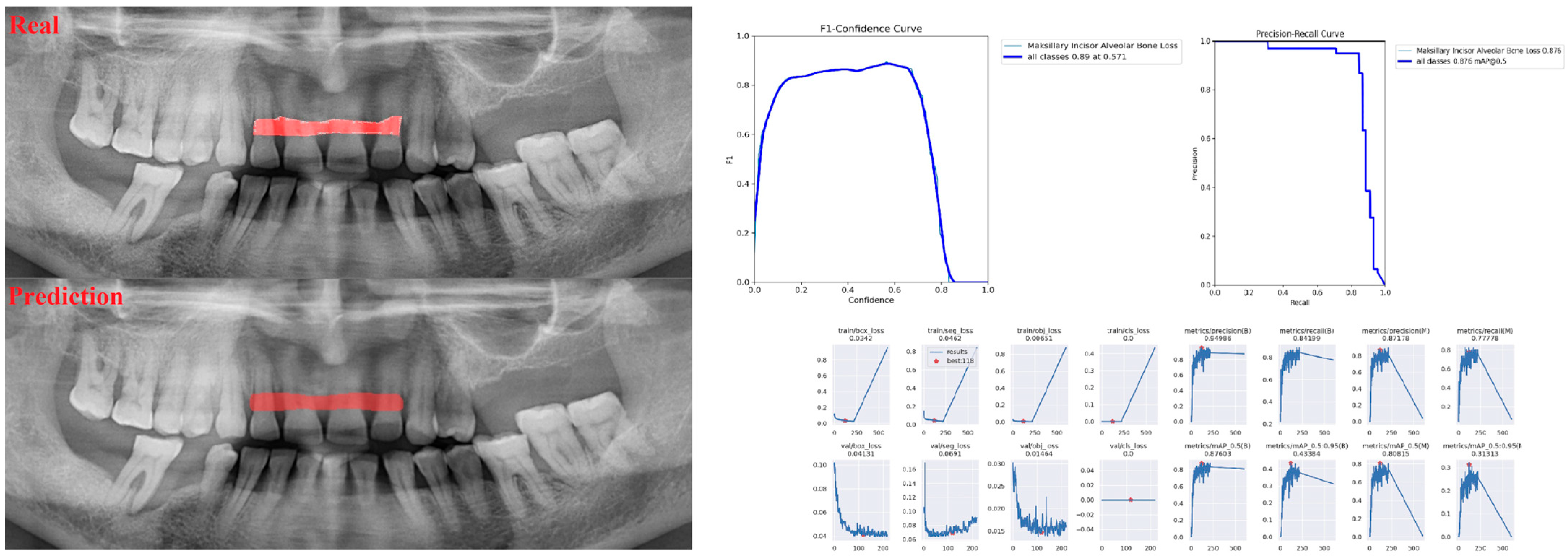 Diagnostics 13 01800 g002 Diagnostics 13 01800 g002