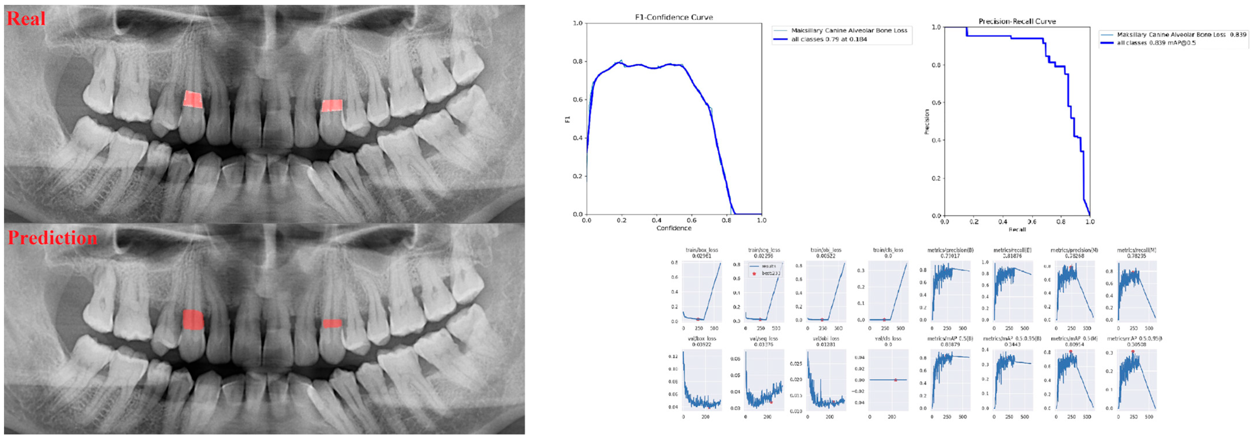 Diagnostics 13 01800 g003 Diagnostics 13 01800 g003