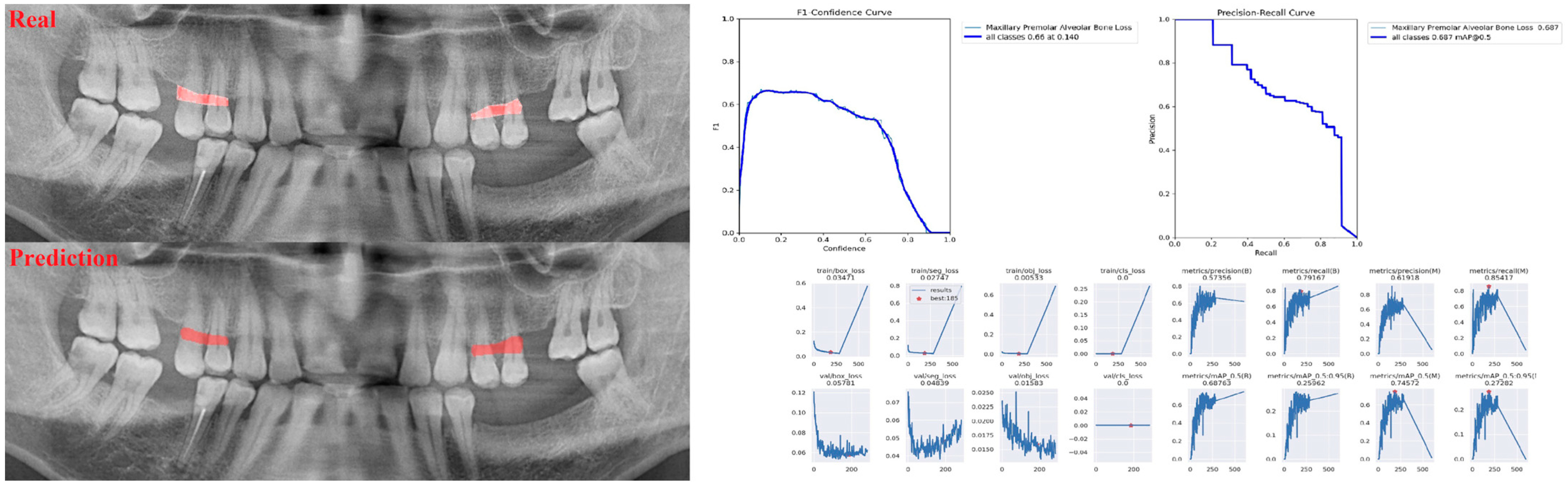 Diagnostics 13 01800 g004 Diagnostics 13 01800 g004