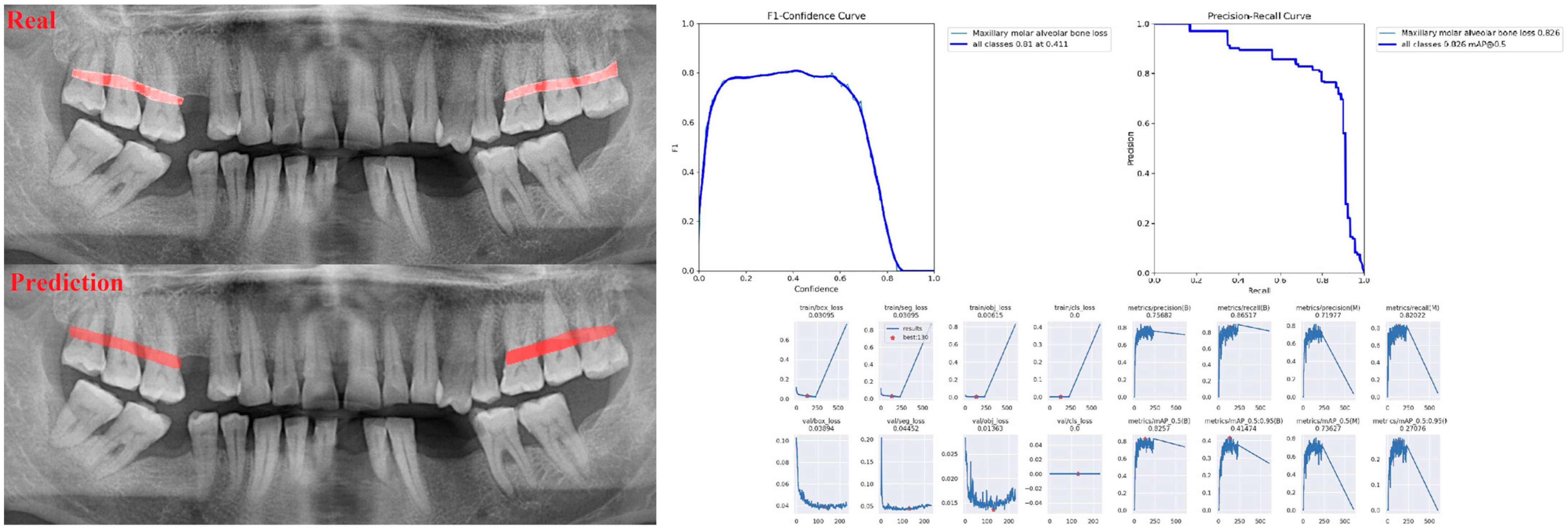 Diagnostics 13 01800 g005 Diagnostics 13 01800 g005