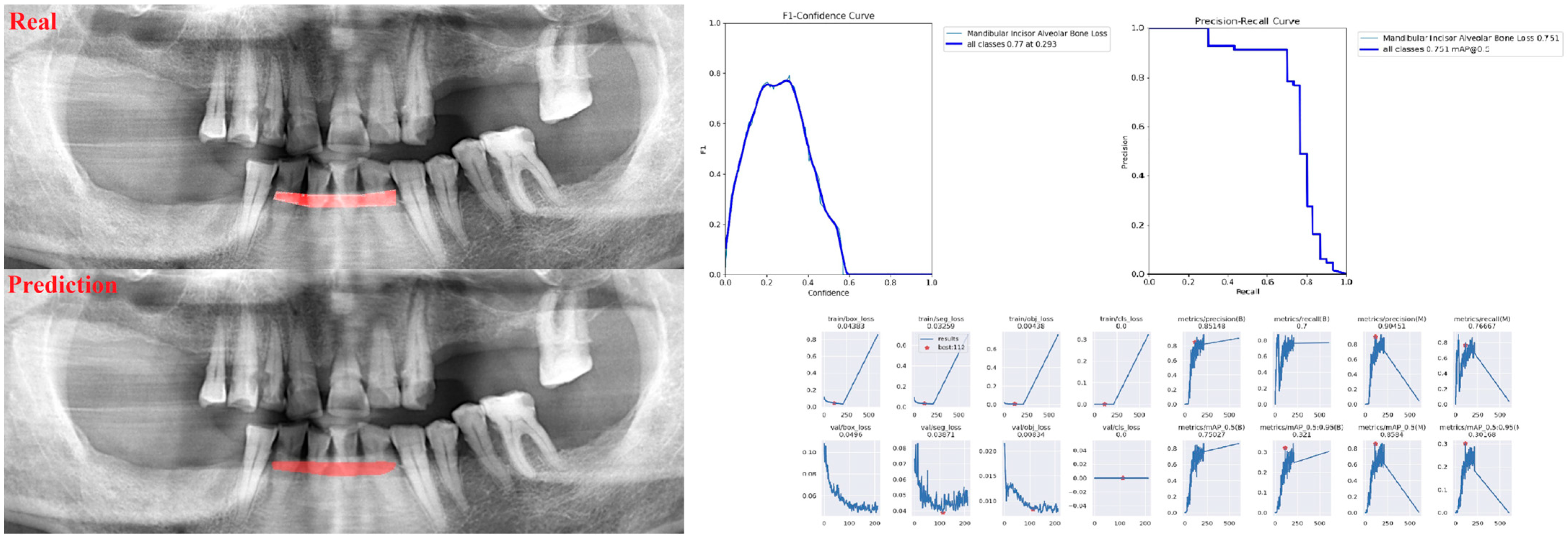 Diagnostics 13 01800 g006 Diagnostics 13 01800 g006