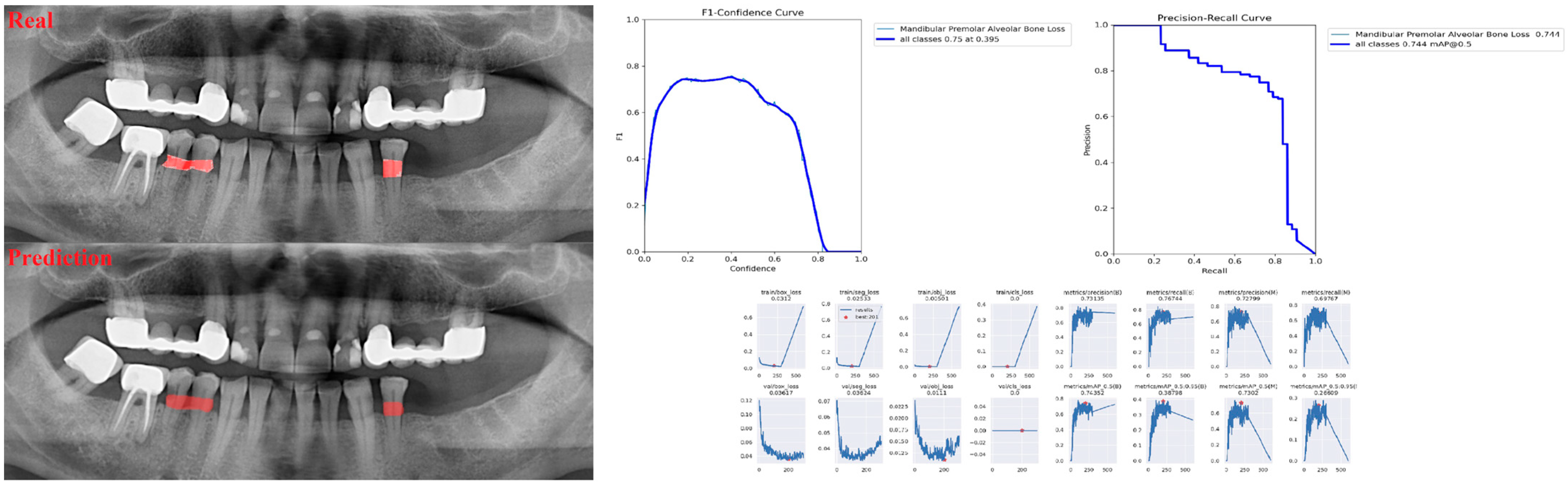 Diagnostics 13 01800 g008 Diagnostics 13 01800 g008