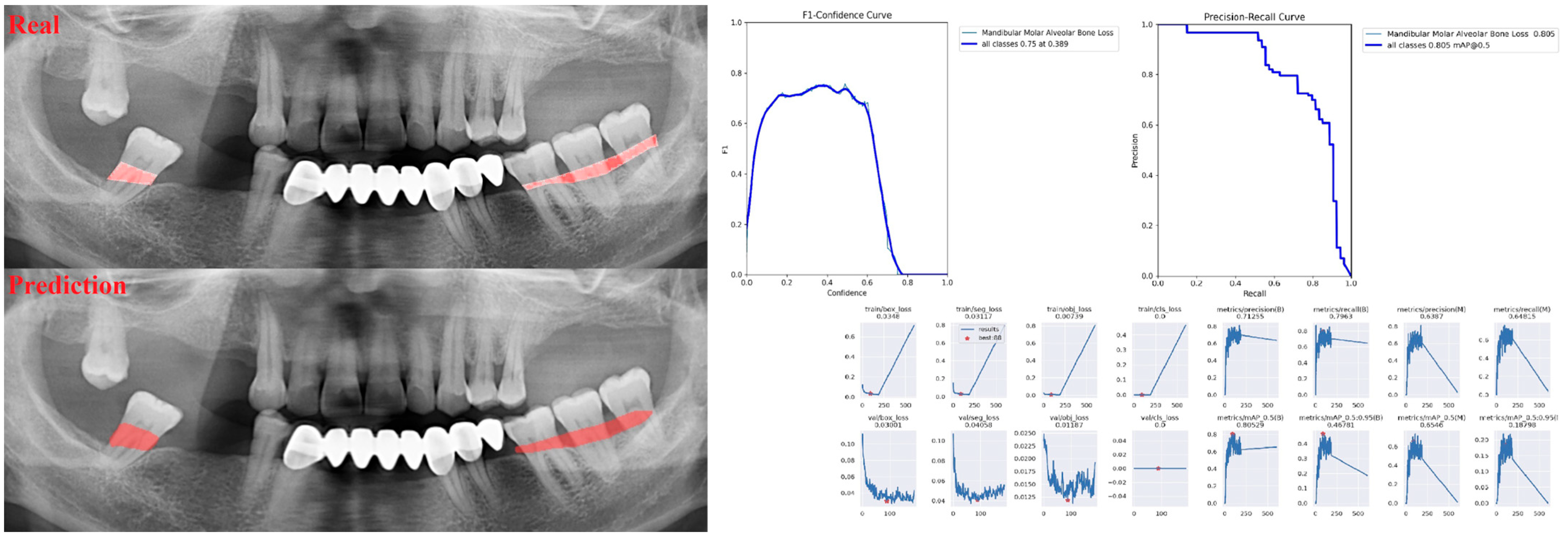 Diagnostics 13 01800 g009 Diagnostics 13 01800 g009