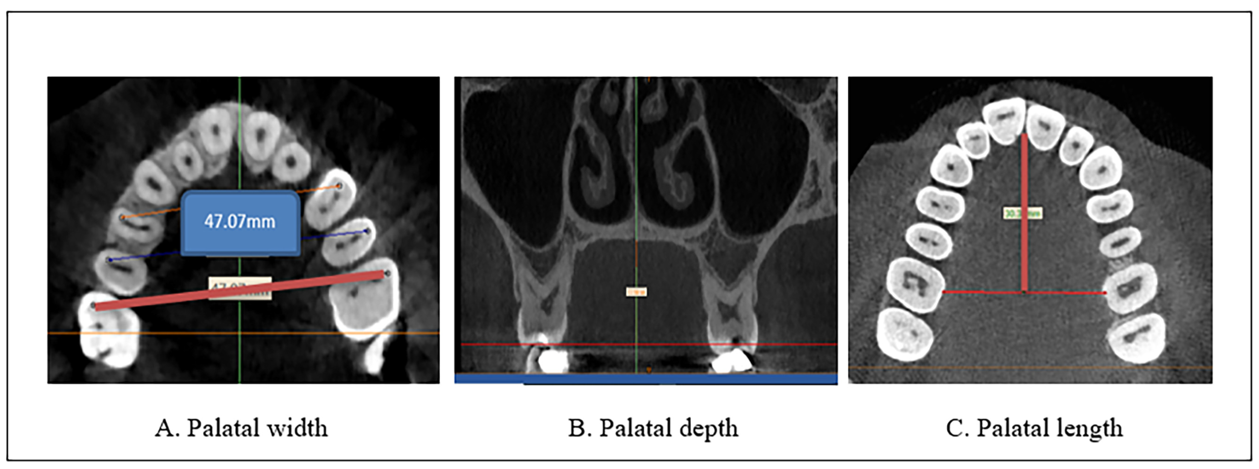 Diagnostics Free FullText ThreeDimensional Measurements of the