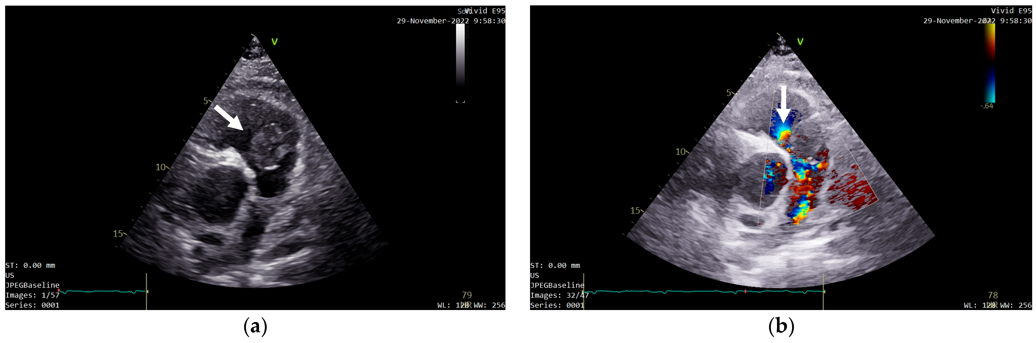 Diagnostics 13 01811 g001