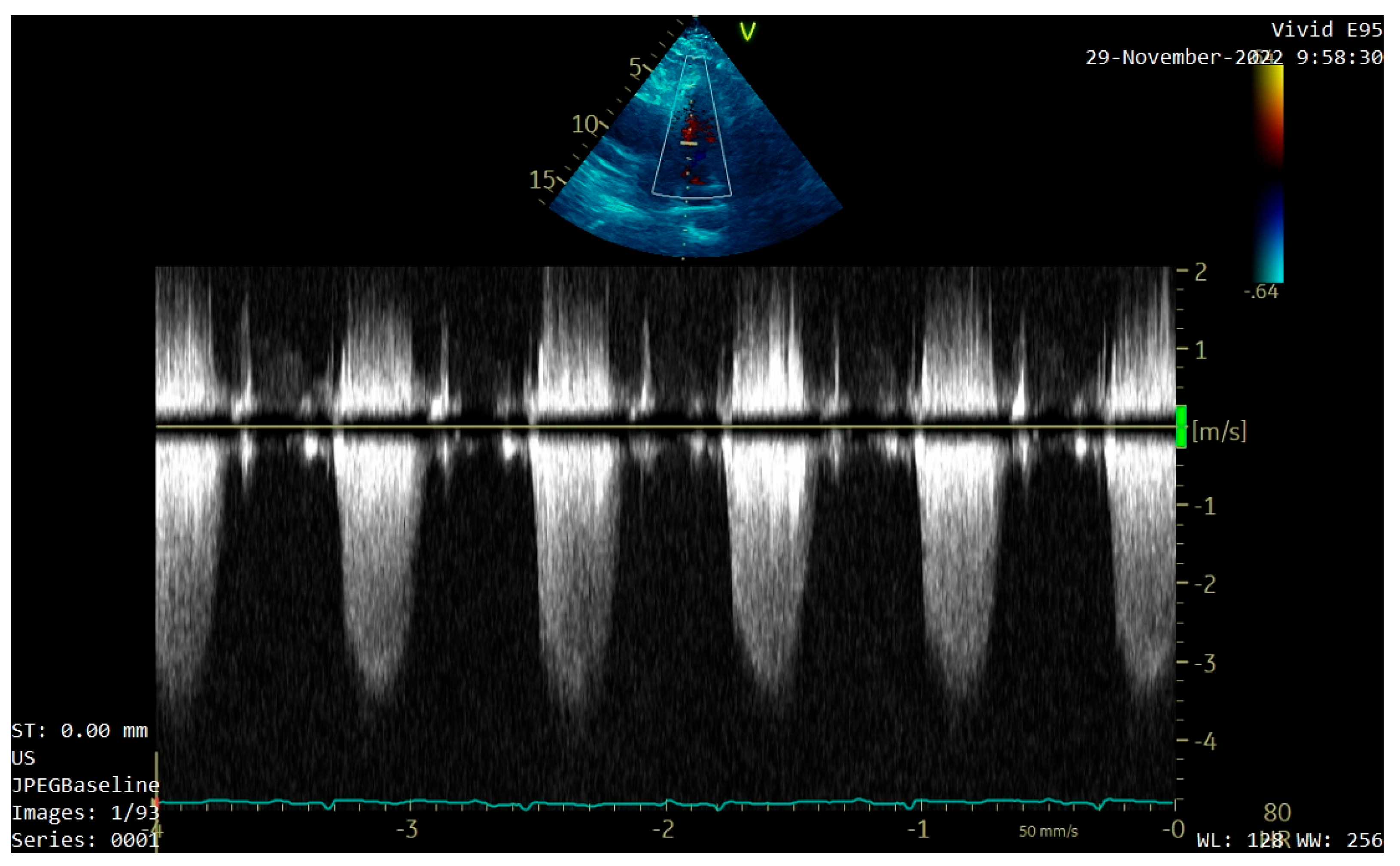 Diagnostics 13 01811 g002