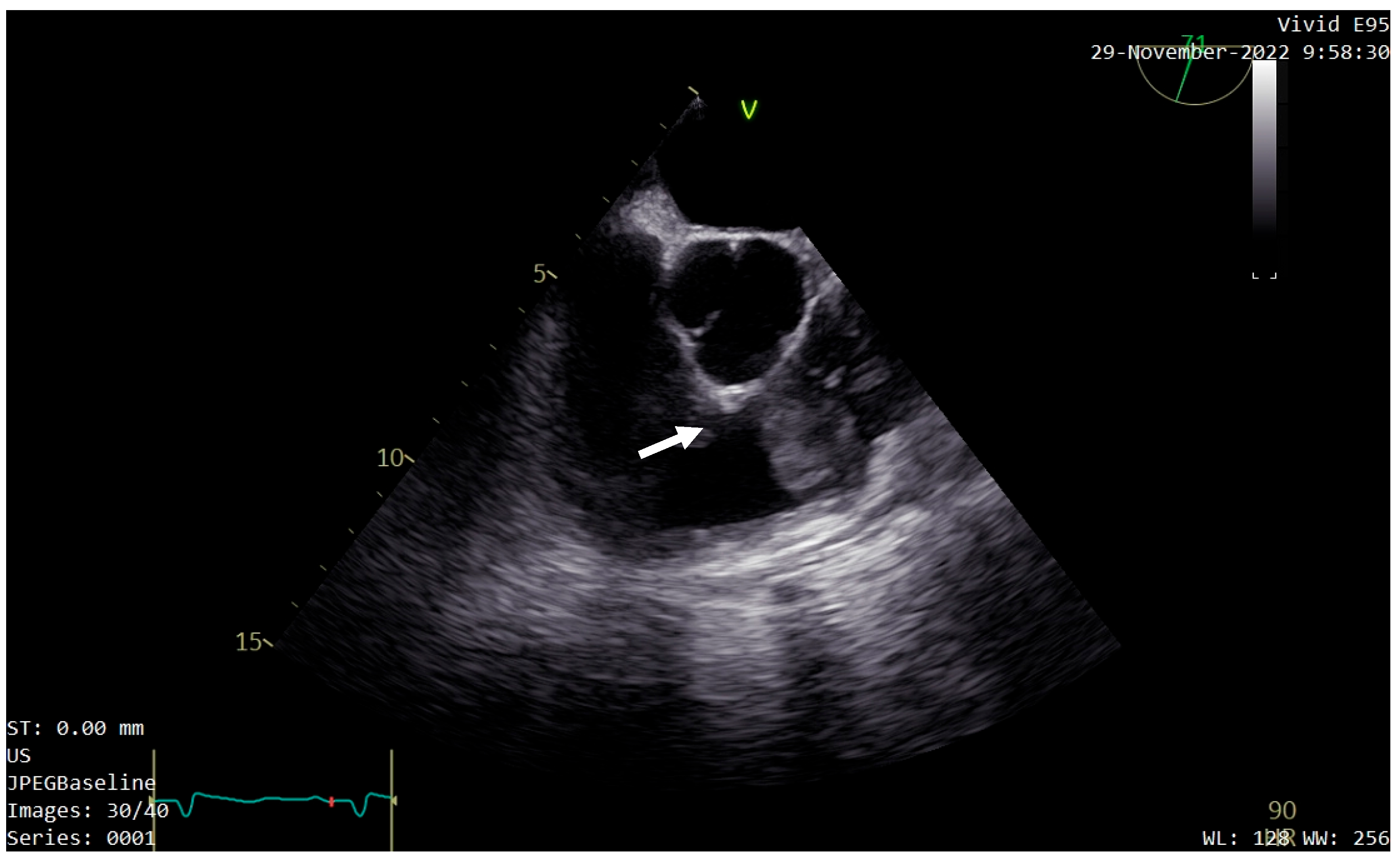 Diagnostics 13 01811 g003