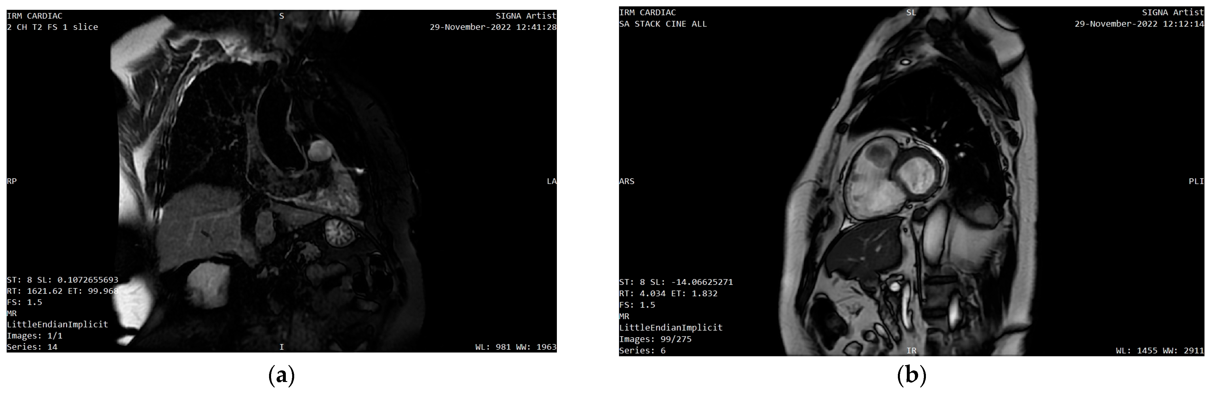 Diagnostics 13 01811 g006