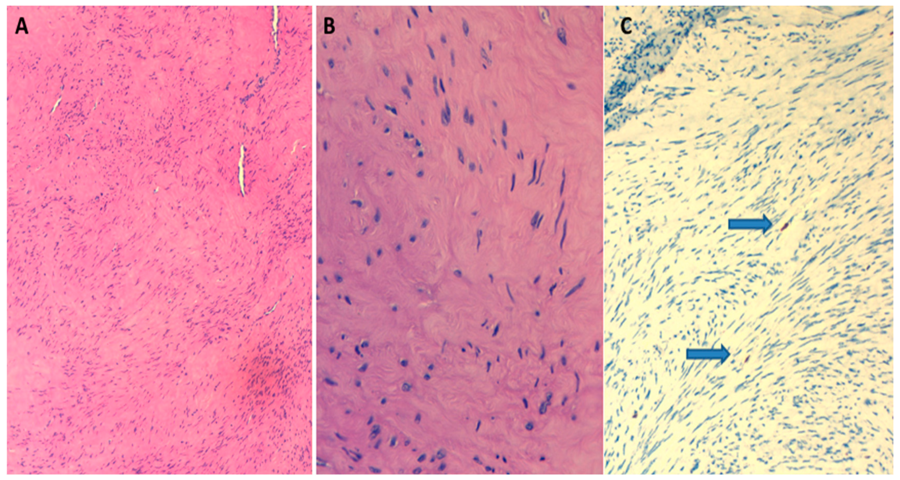 Diagnostics 13 01818 g004 Diagnostics 13 01818 g004
