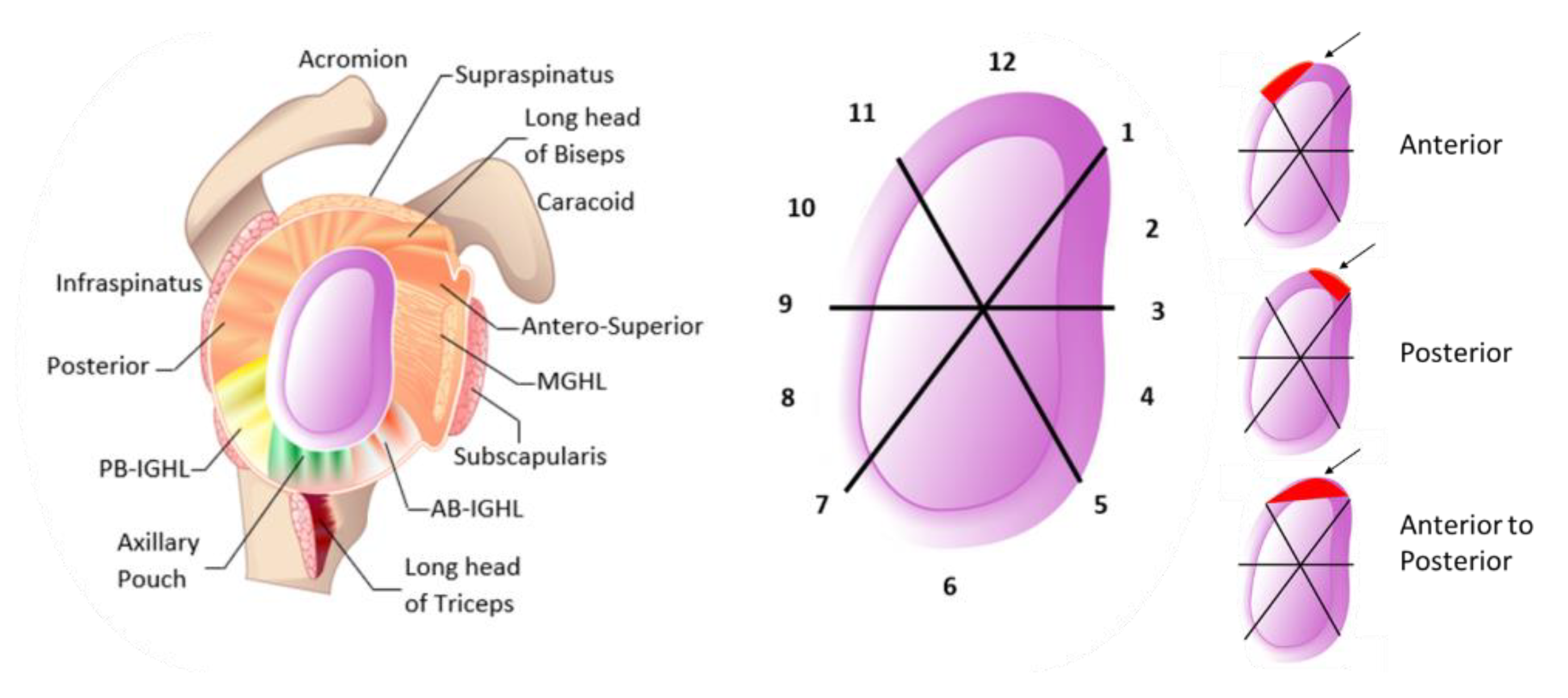Diagnostics 13 01819 g006 Diagnostics 13 01819 g006