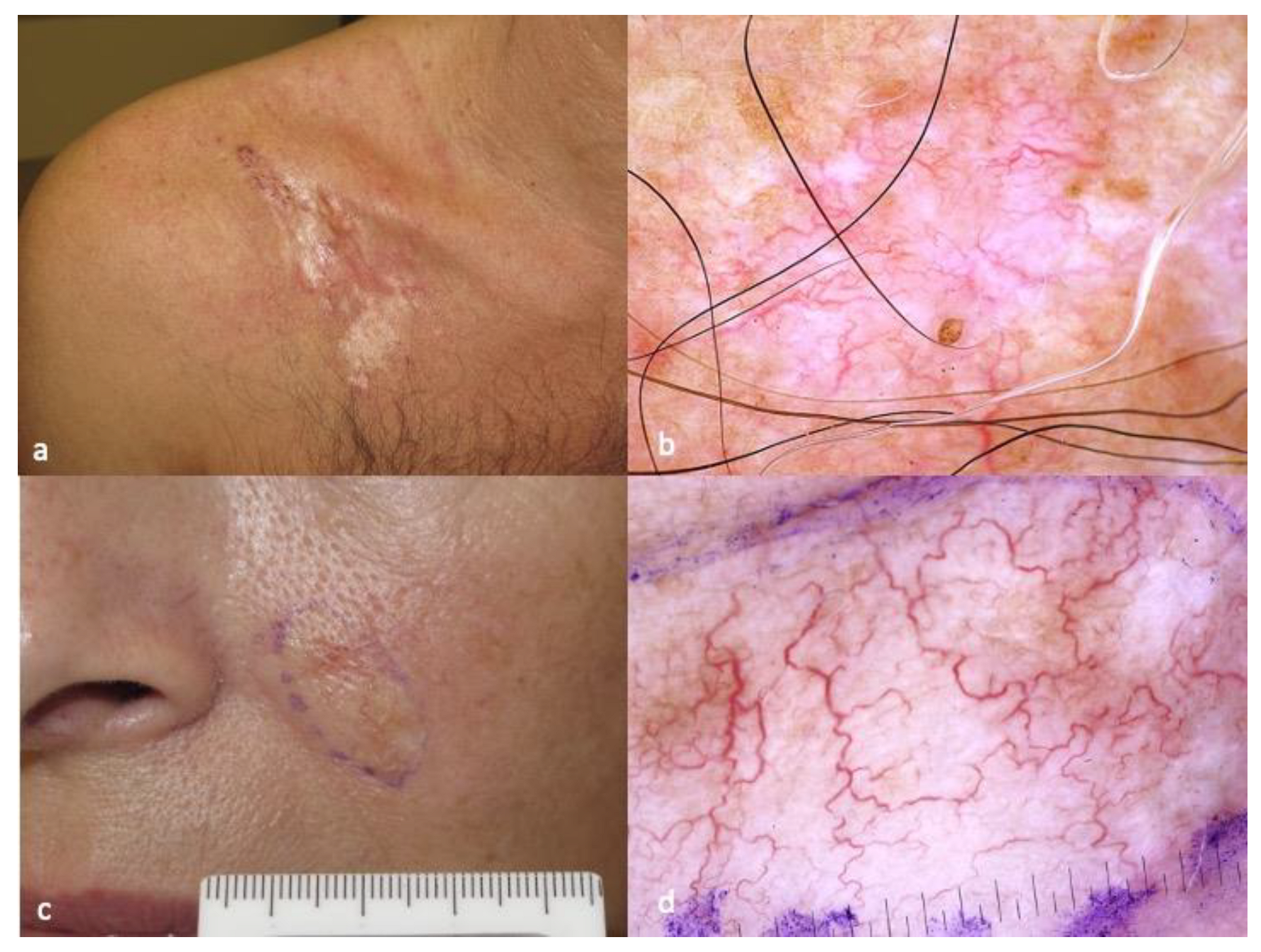 Diagnostics 13 01822 g001 Diagnostics 13 01822 g001