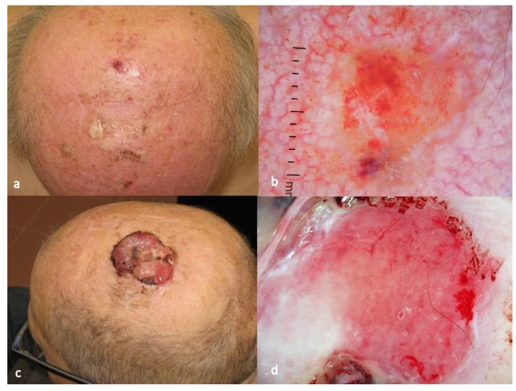 Diagnostics 13 01822 g003 Diagnostics 13 01822 g003