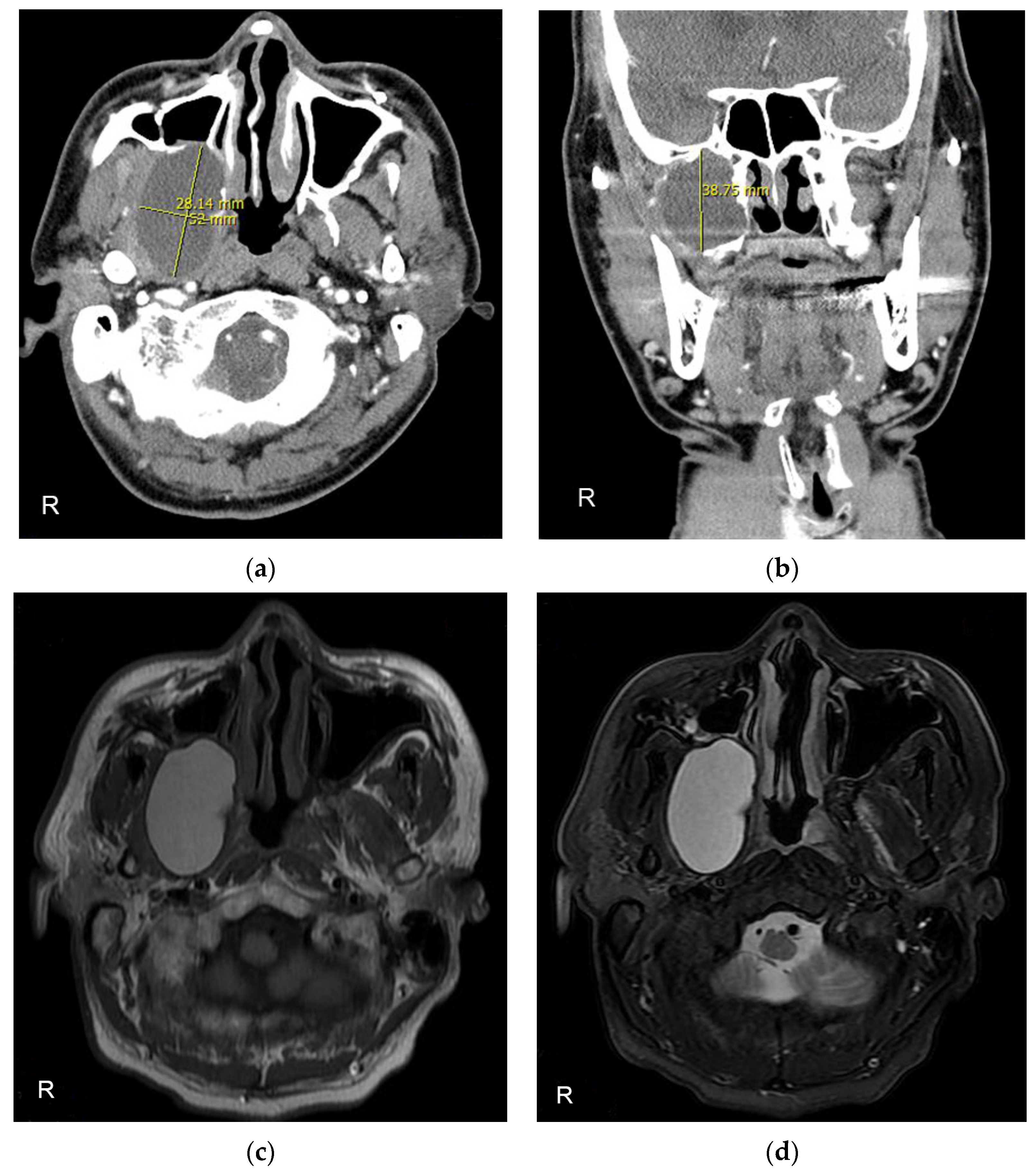Diagnostics 13 01825 g002 Diagnostics 13 01825 g002
