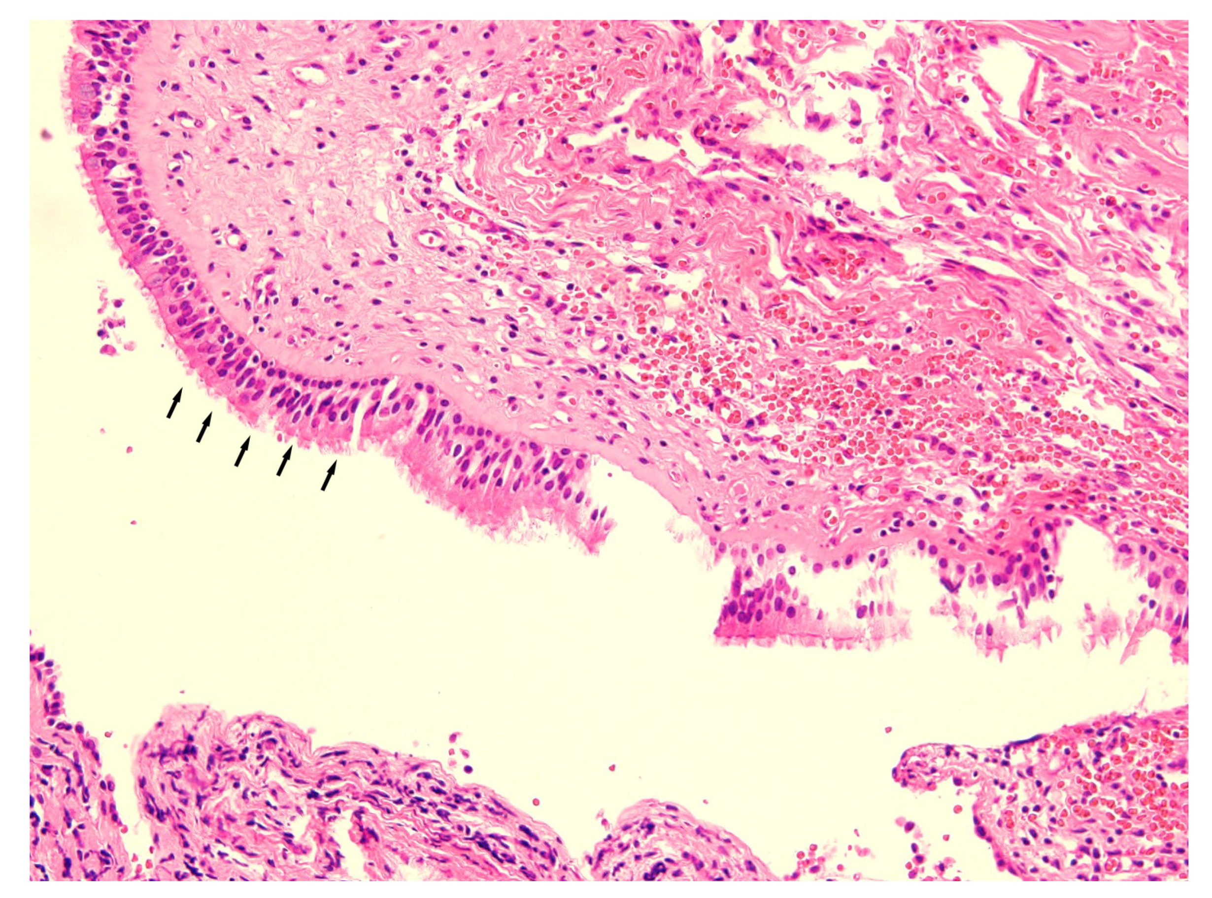 Diagnostics 13 01825 g003 Diagnostics 13 01825 g003