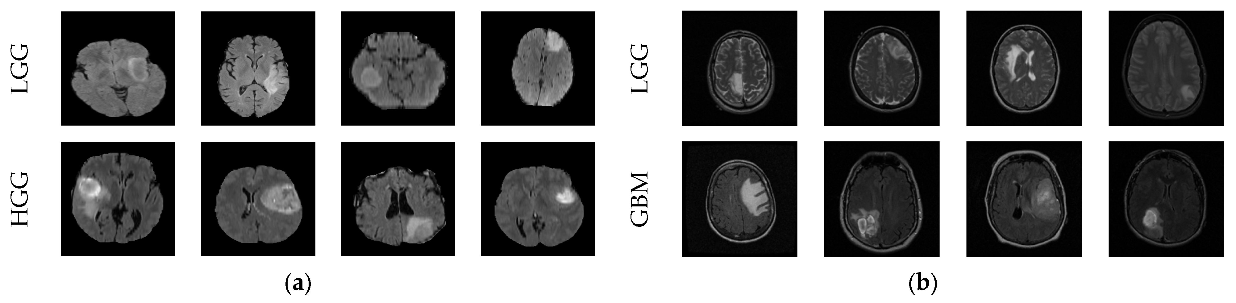 Diagnostics 13 01832 g002 Diagnostics 13 01832 g002