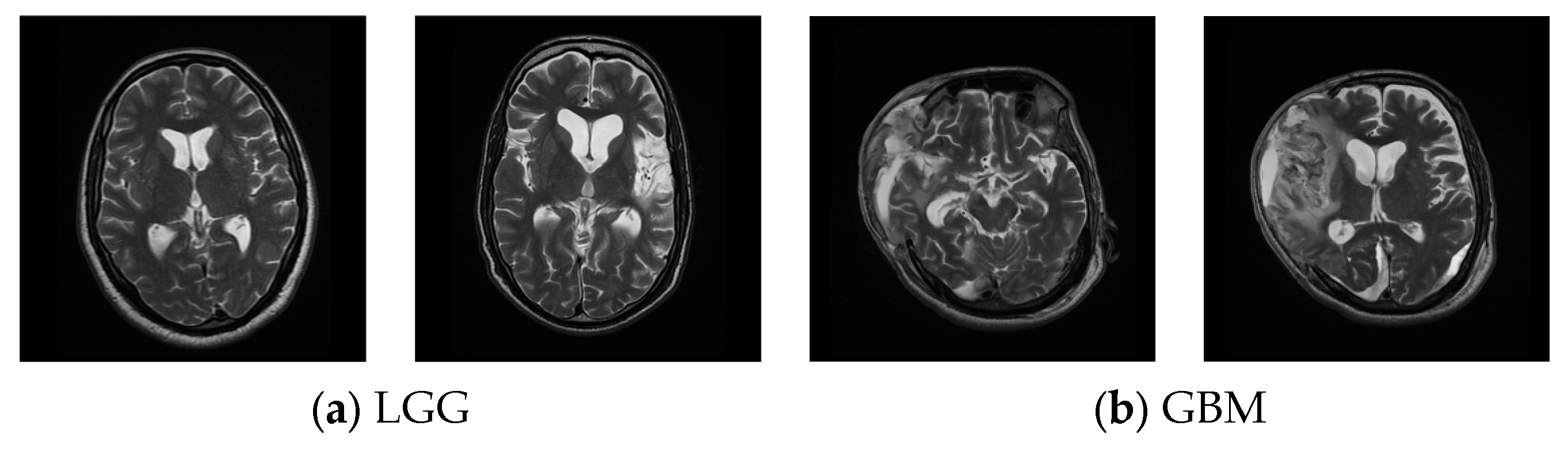 Diagnostics 13 01832 g003 Diagnostics 13 01832 g003