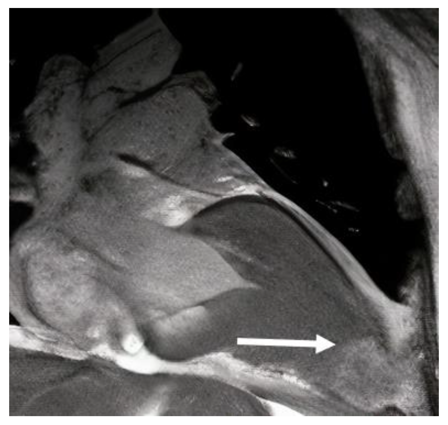 Diagnostics 13 01848 g005 Diagnostics 13 01848 g005