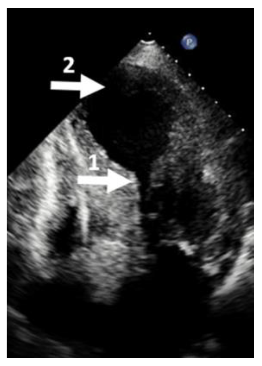 Diagnostics 13 01848 g006 Diagnostics 13 01848 g006