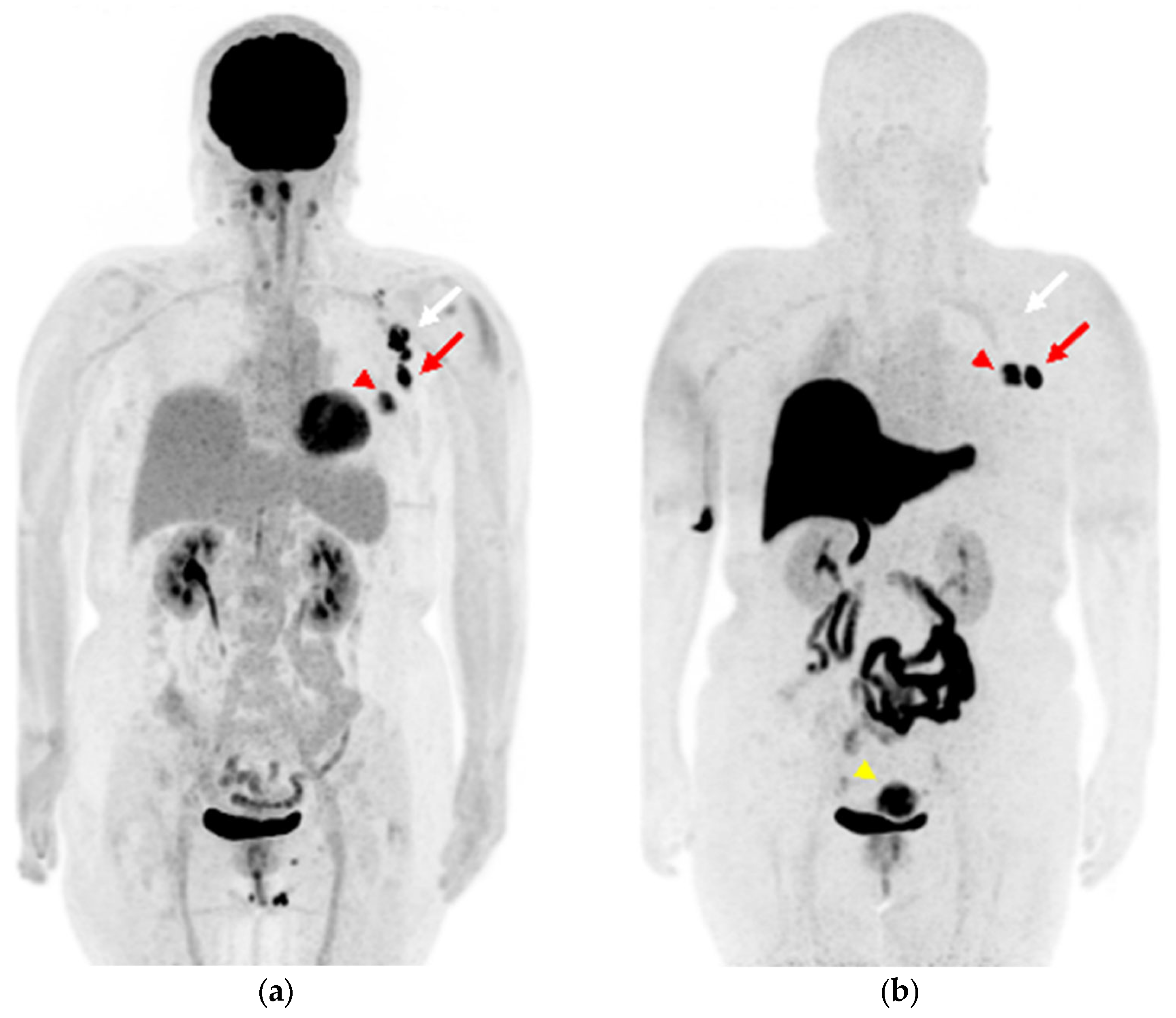 Diagnostics 13 01851 g001
